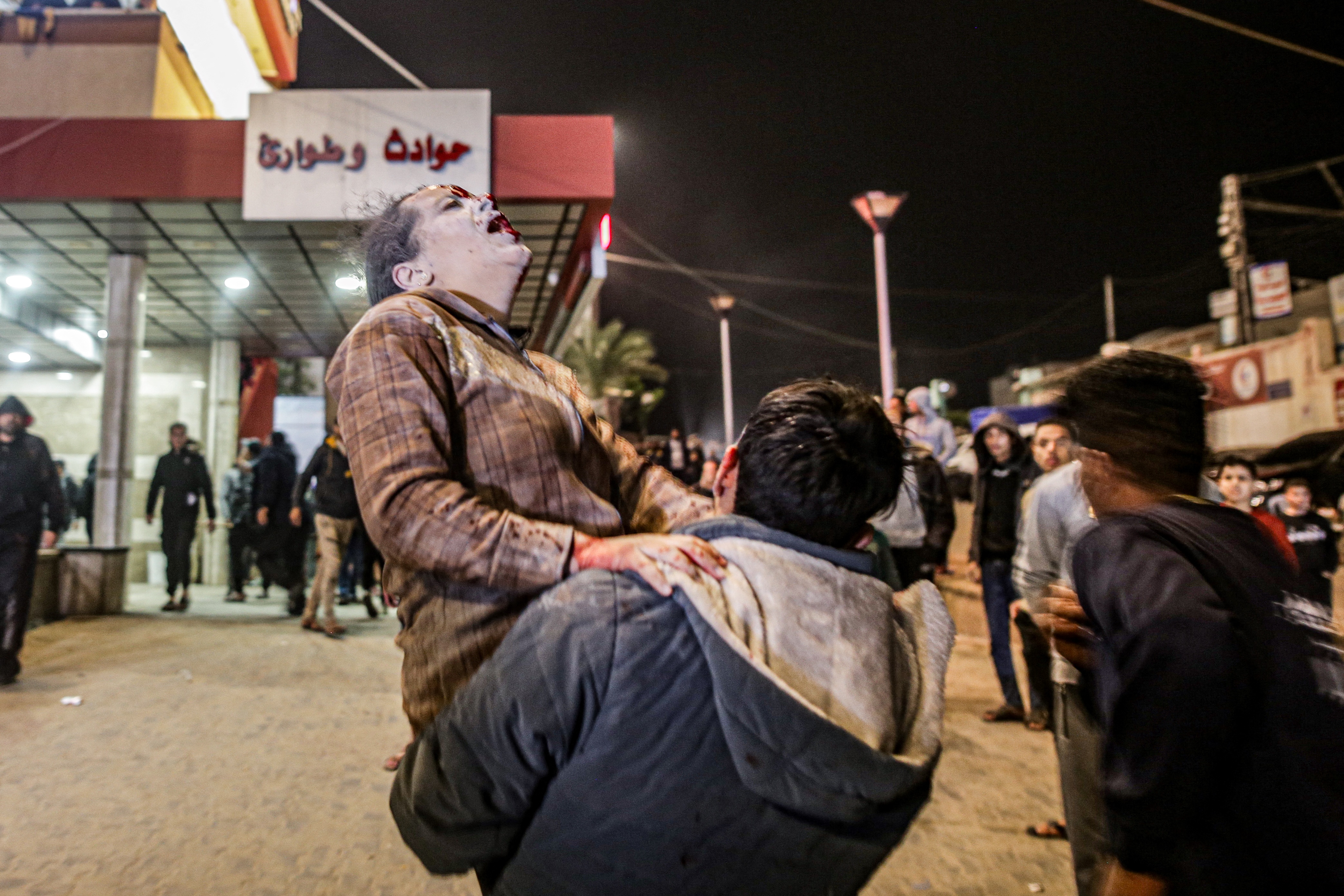 A man carrying a child, injured following Israeli bombardment, arrives to Nasser hospital in Khan Yunis in the southern Gaza Strip.