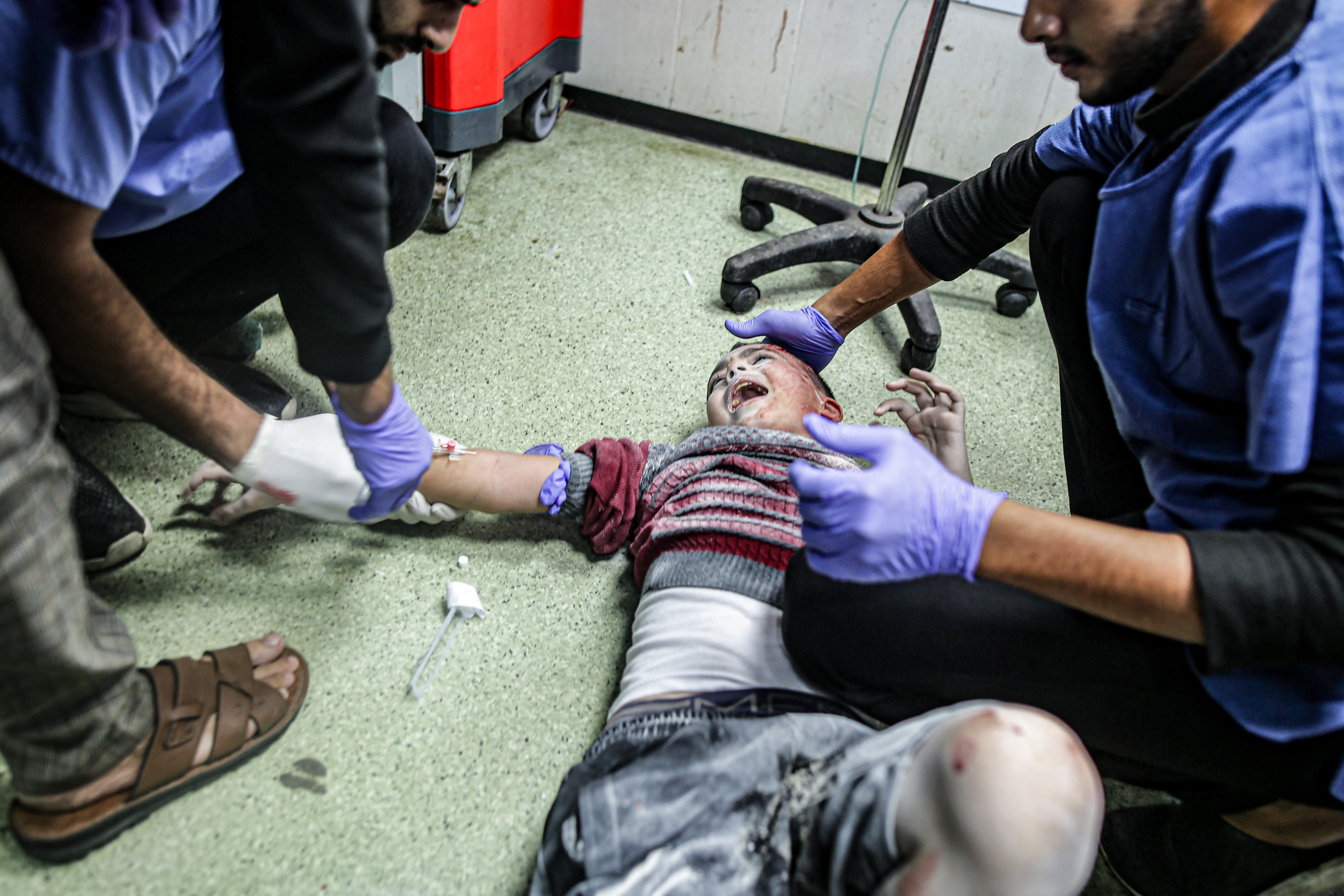 A child who was injured following Israeli bombardment grimaces as he receives medical care at Nasser hospital in Khan Yunis.