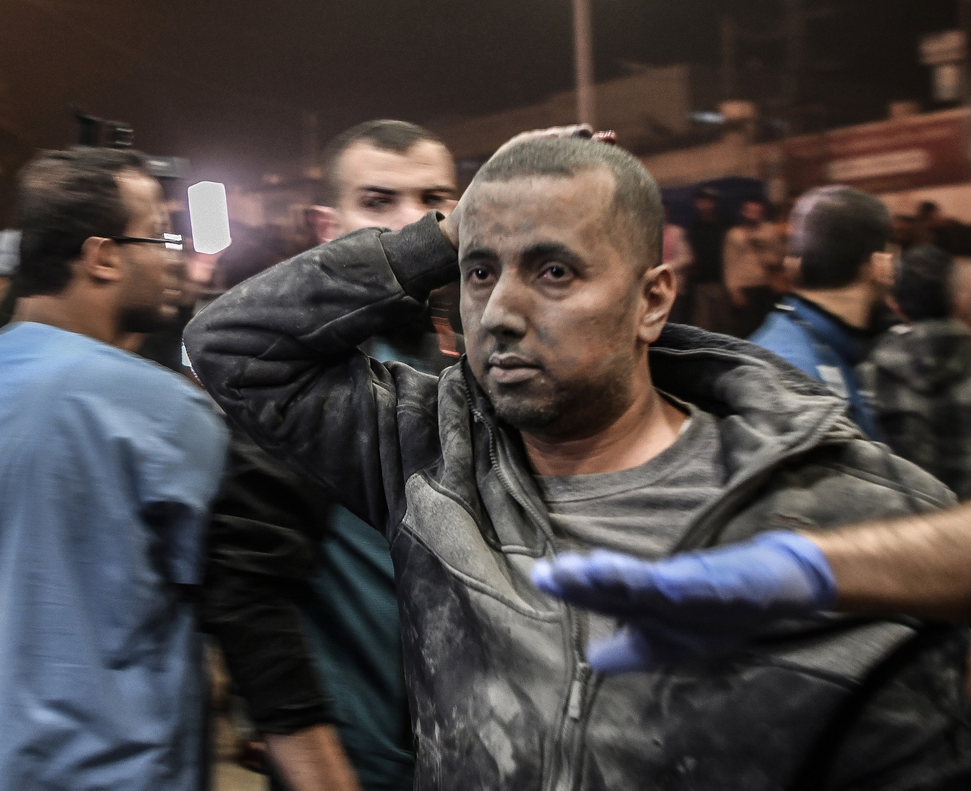 An injured Palestinian is taken to the Nasser Hospital for a treatment following the Israeli attacks in Khan Yunis, Gaza on December 4