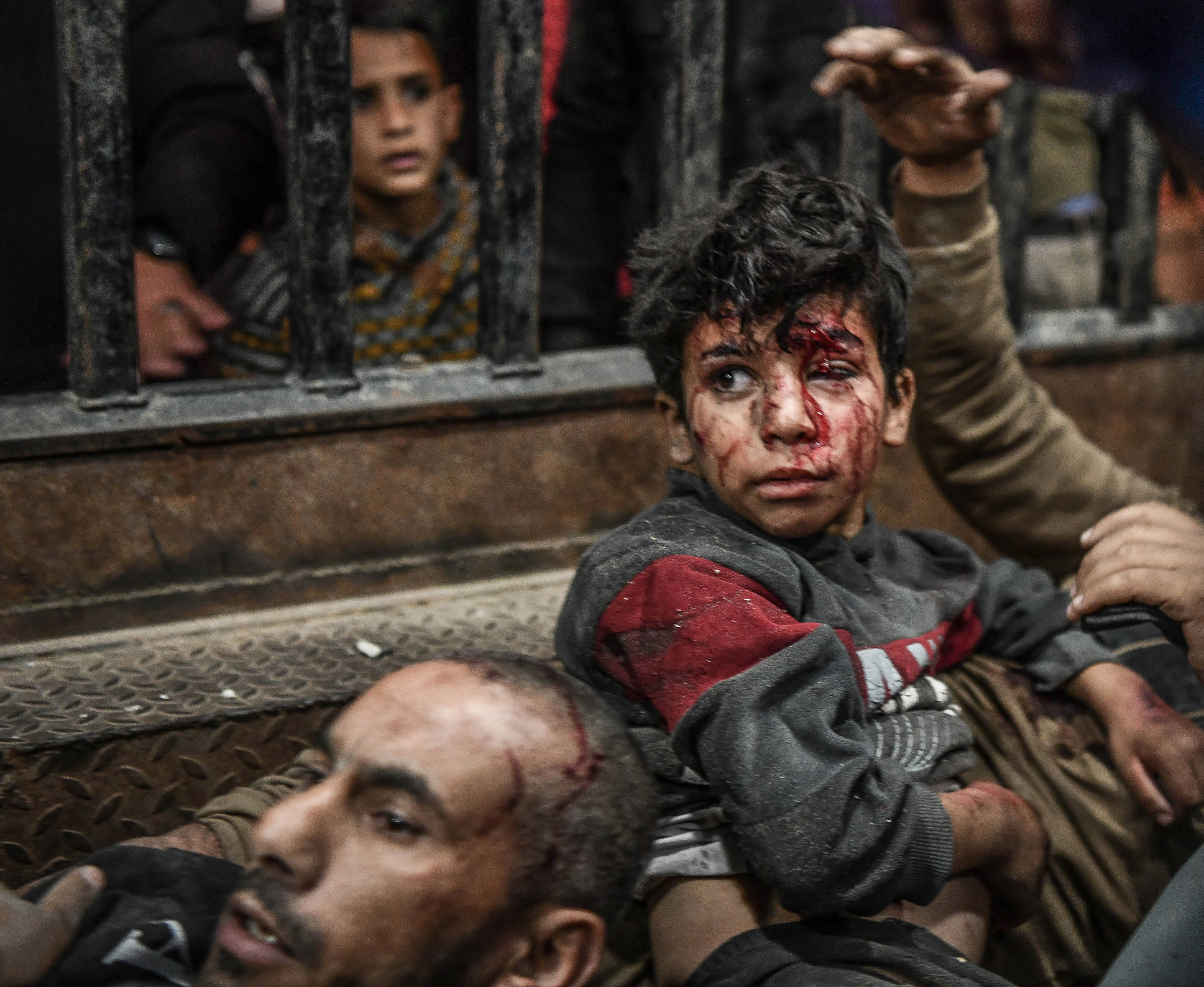 Injured Palestinians, including children, are taken to the Nasser Hospital following the Israeli attacks in Khan Yunis, Gaza on December 4