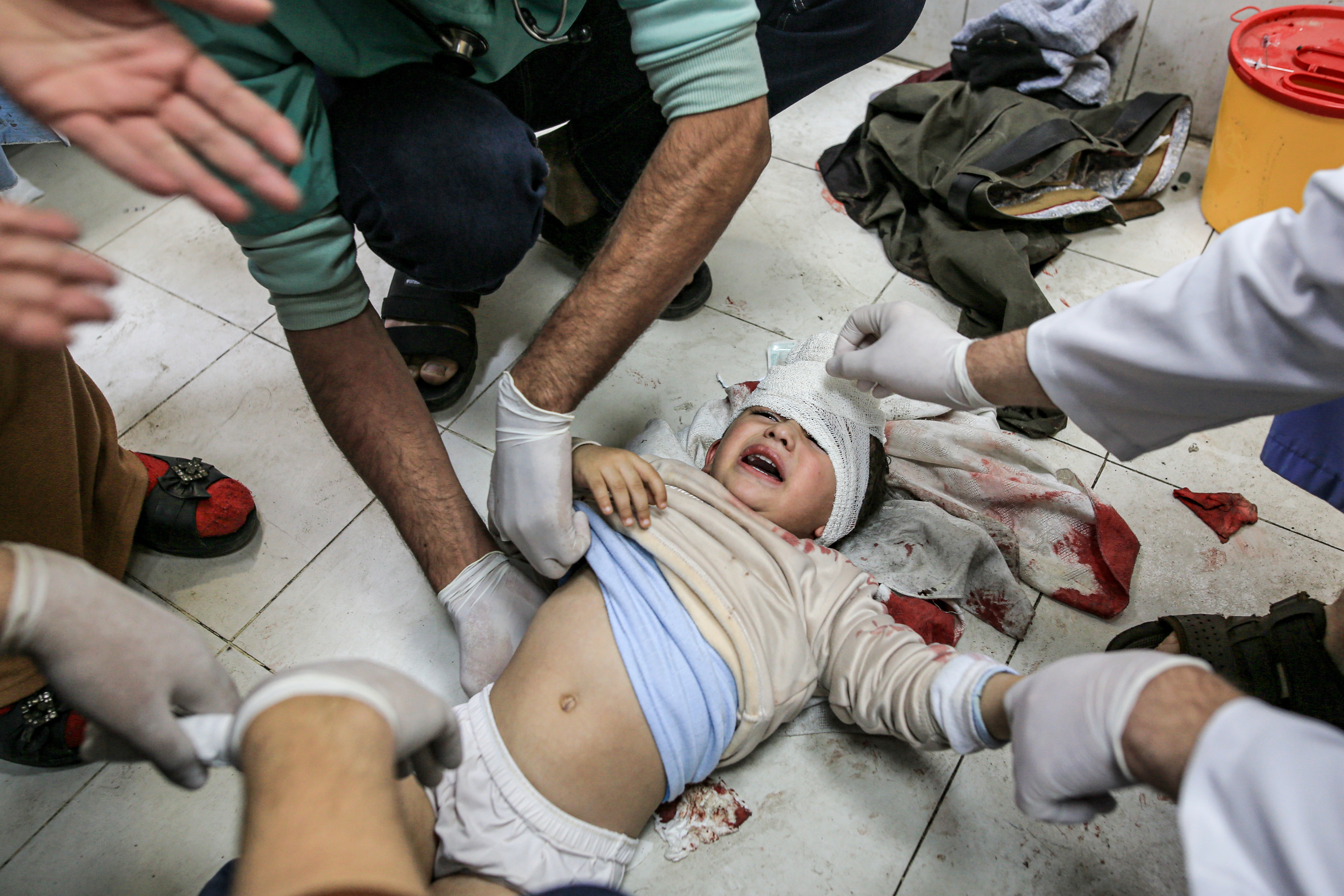 Injured Palestinians, including children, are brought to Nasser Hospital for medical treatment as Israeli attacks continue in Khan Yunis, Gaza.