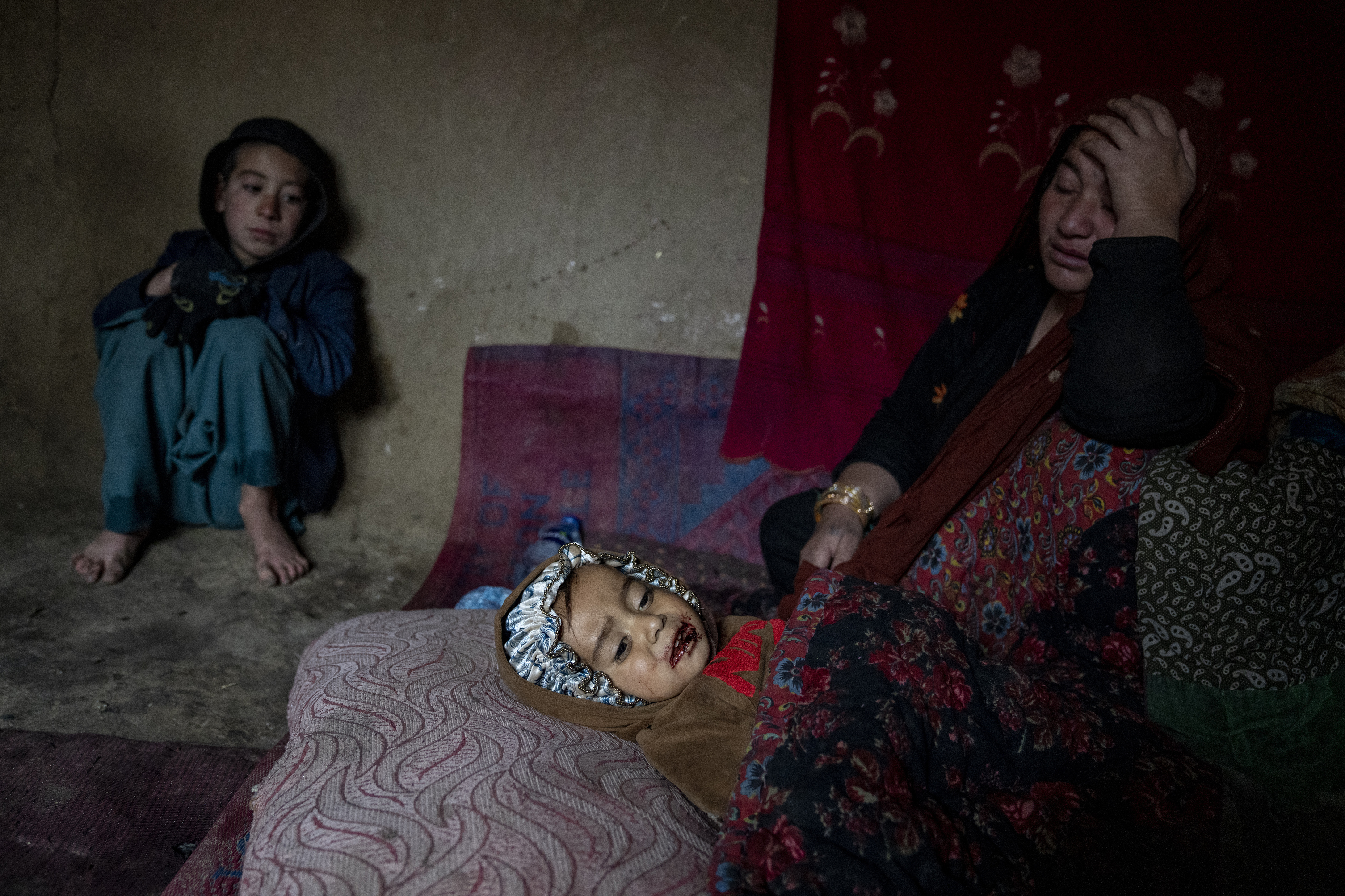 An internally displaced woman takes care of her sick child in a camp on the outskirts of Kabul, Afghanistan, Thursday, Feb. 9