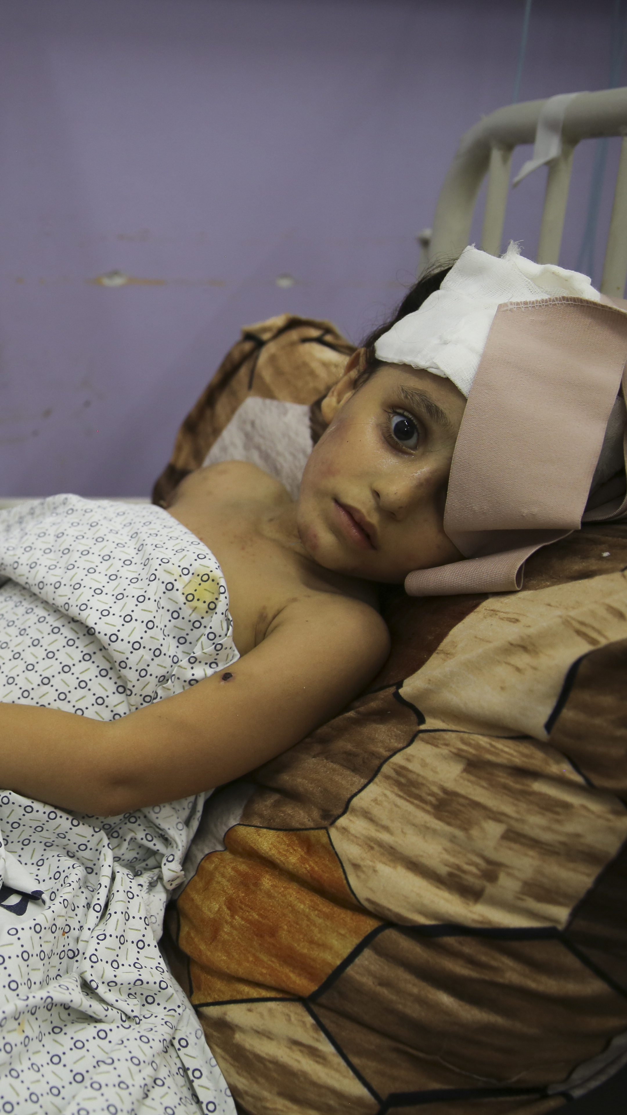 Kenzi al Madhoun, a four-year-old who was wounded in Israeli bombardment, lies at Al Aqsa Hospital in Deir al Balah City