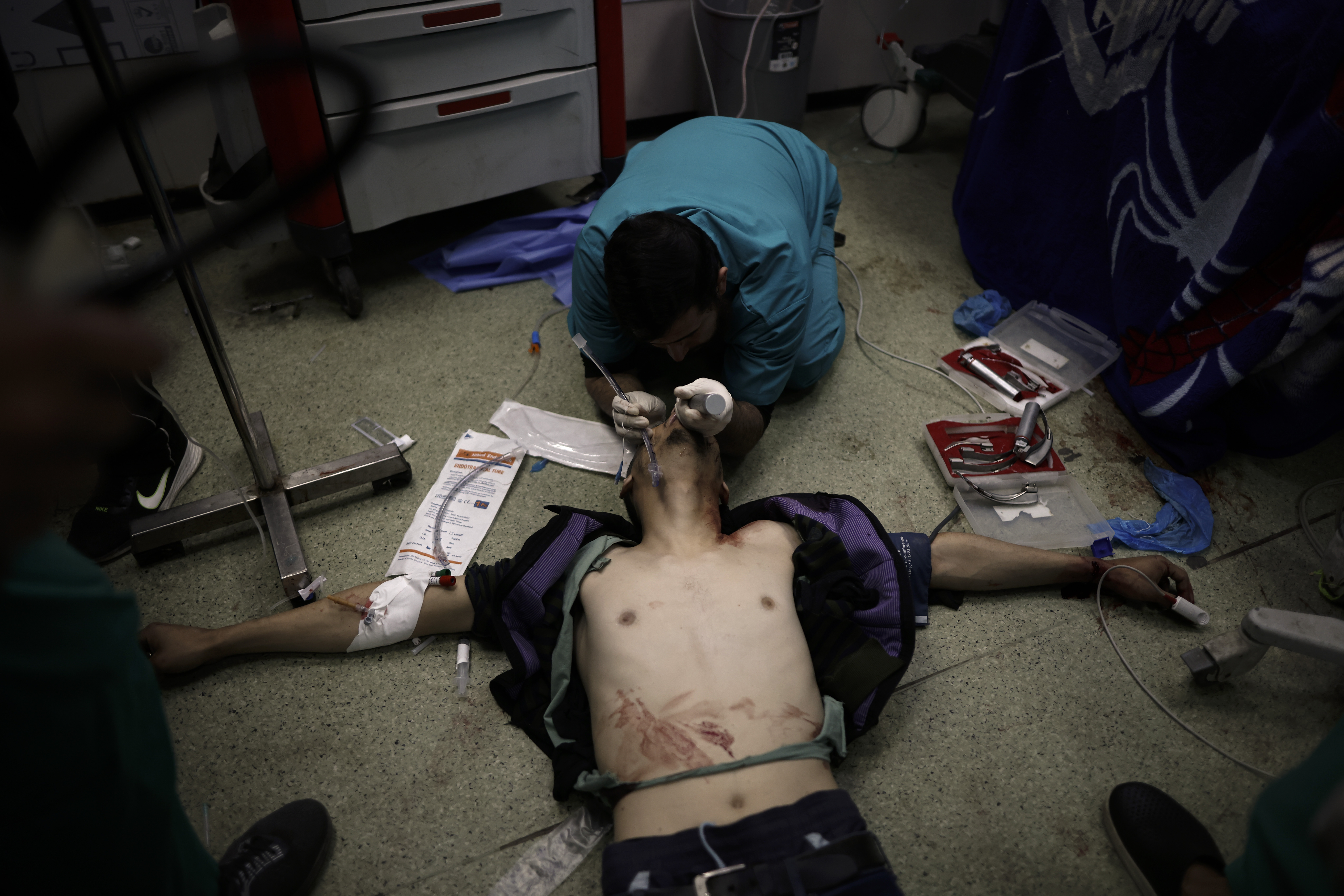 A Palestinian wounded in the Israeli bombardment of the Gaza Strip receives treatment at the Nasser hospital in Khan Younis, Southern Gaza Strip