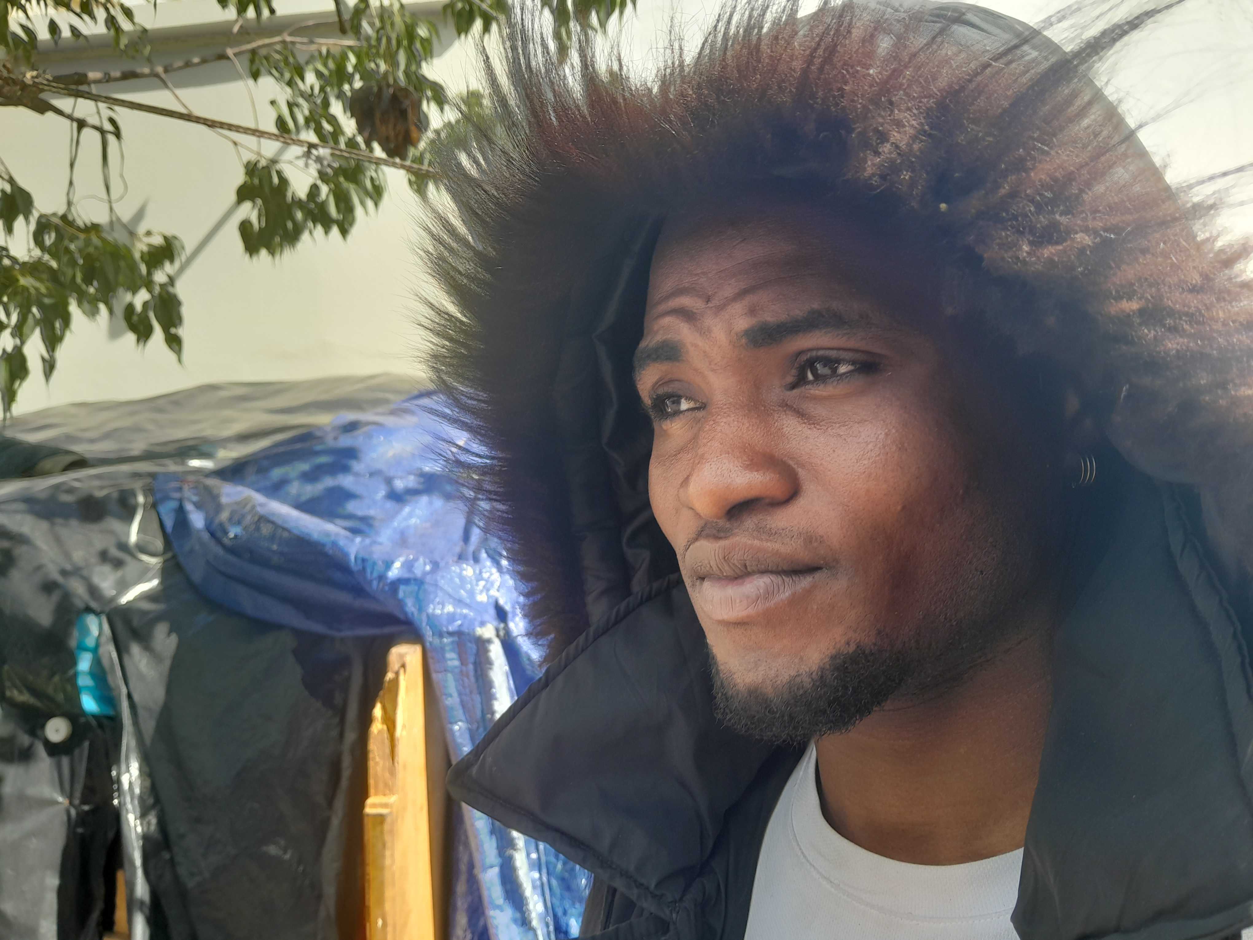 Mohammed Lamin Kamara, 19, from Sierra Leone, shows the scars from his time in a Libyan prison