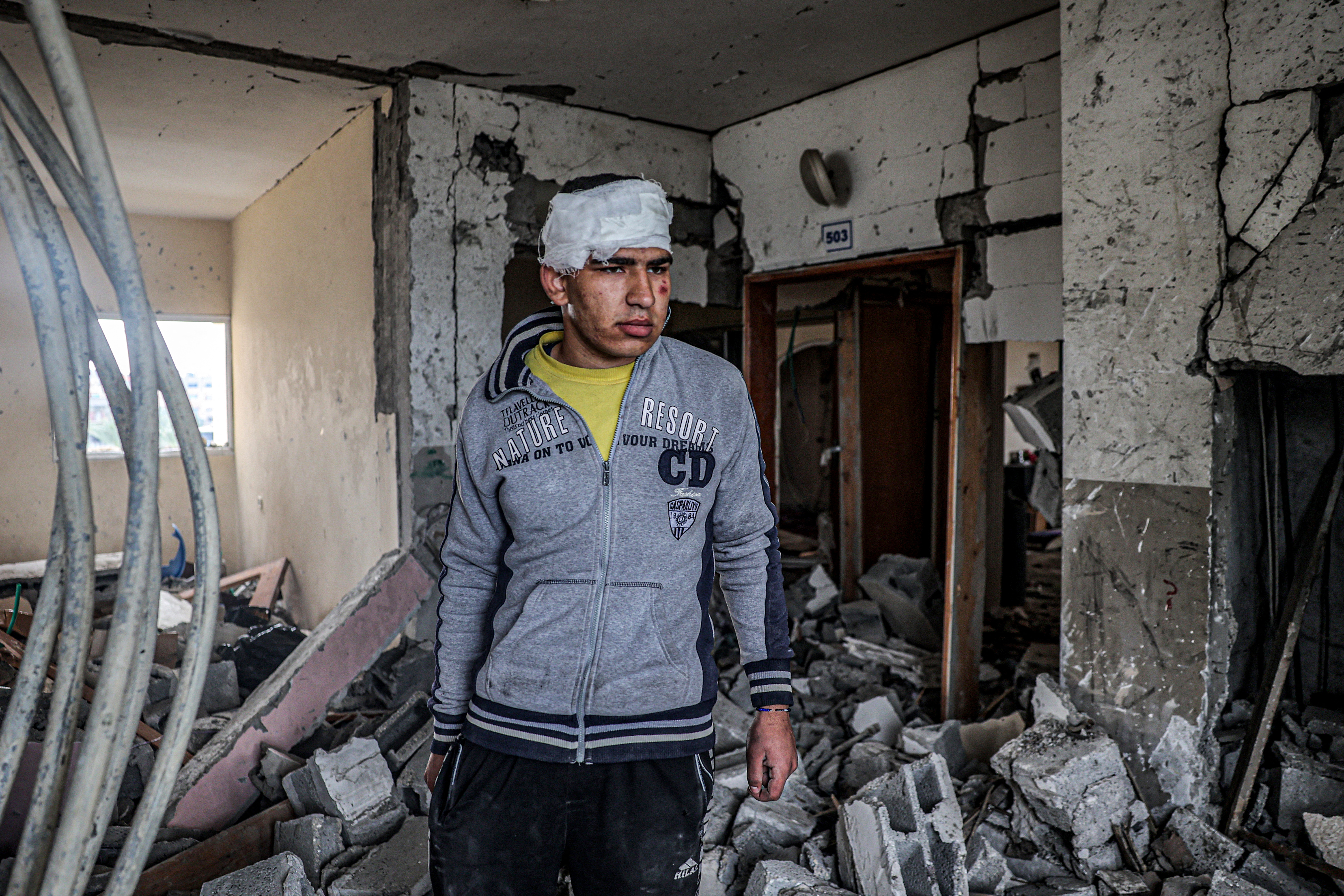 An injured boy inspects the rubble and debris of a building that was hit by overnight Israeli bombardment in Rafah in the southern Gaza Strip