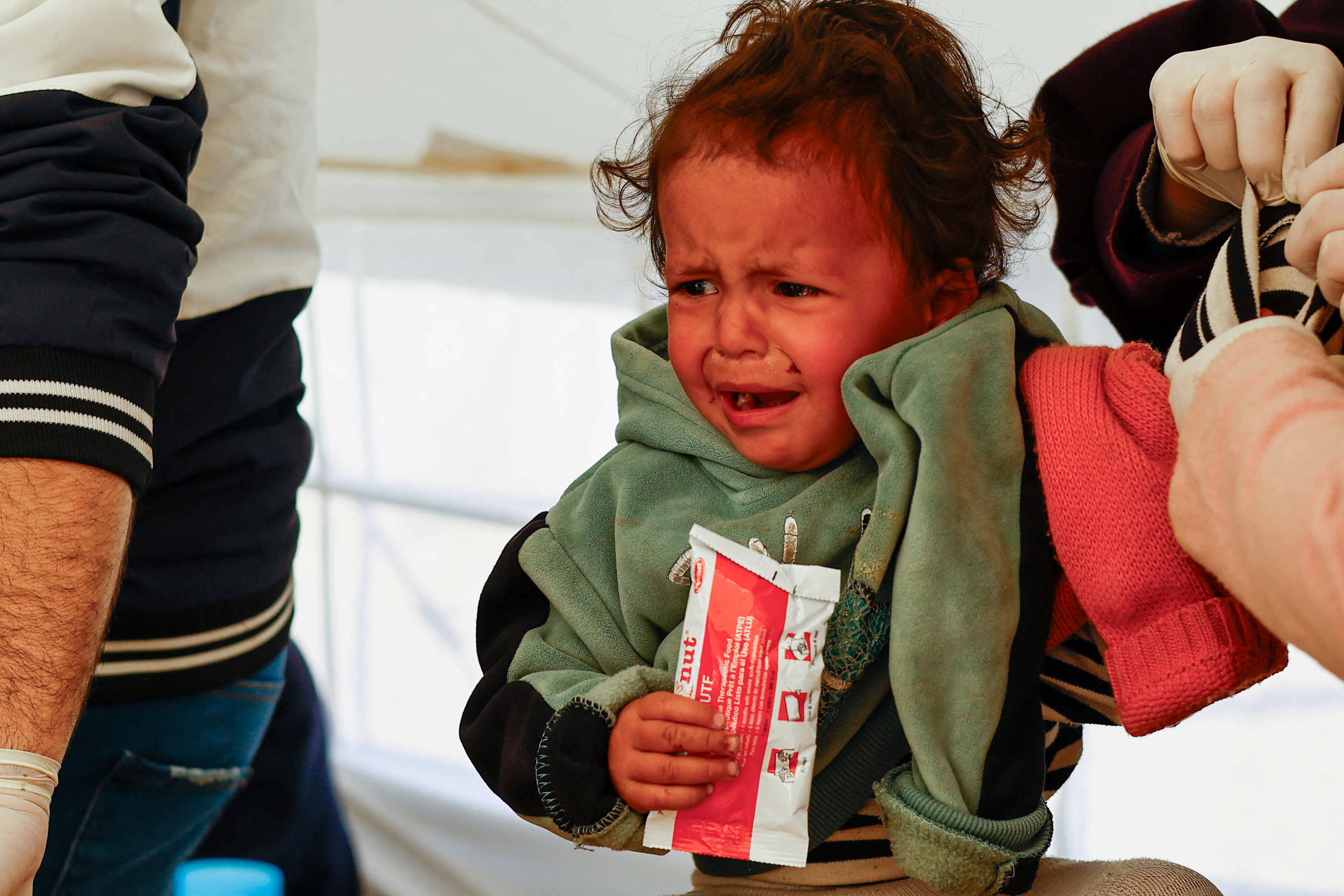 A Palestinian girl is checked for malnutrition