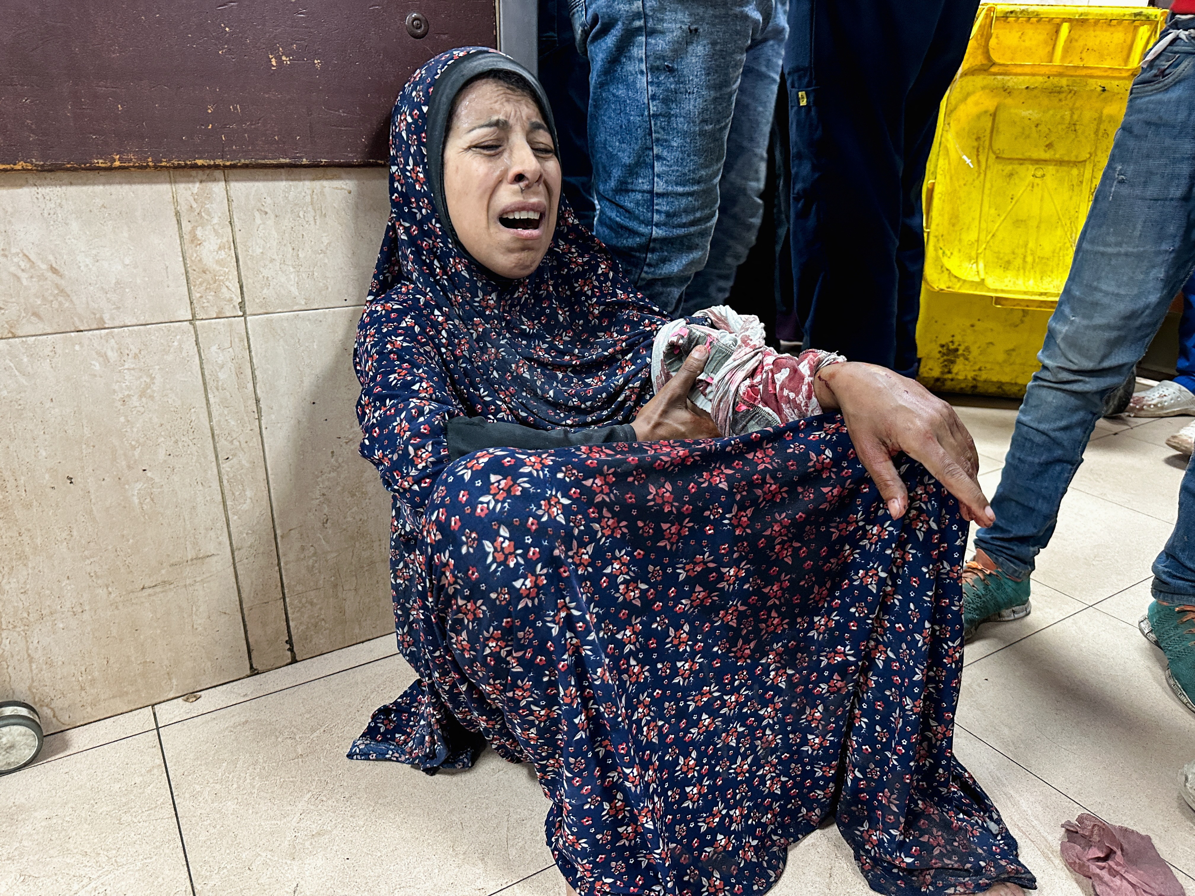 An injured woman sits at Al-Aqsa Martyrs Hospital, in the aftermath of an Israeli strike, amid the Israel-Hamas conflict, in Deir Al-Balah, in the central Gaza Strip, June 8