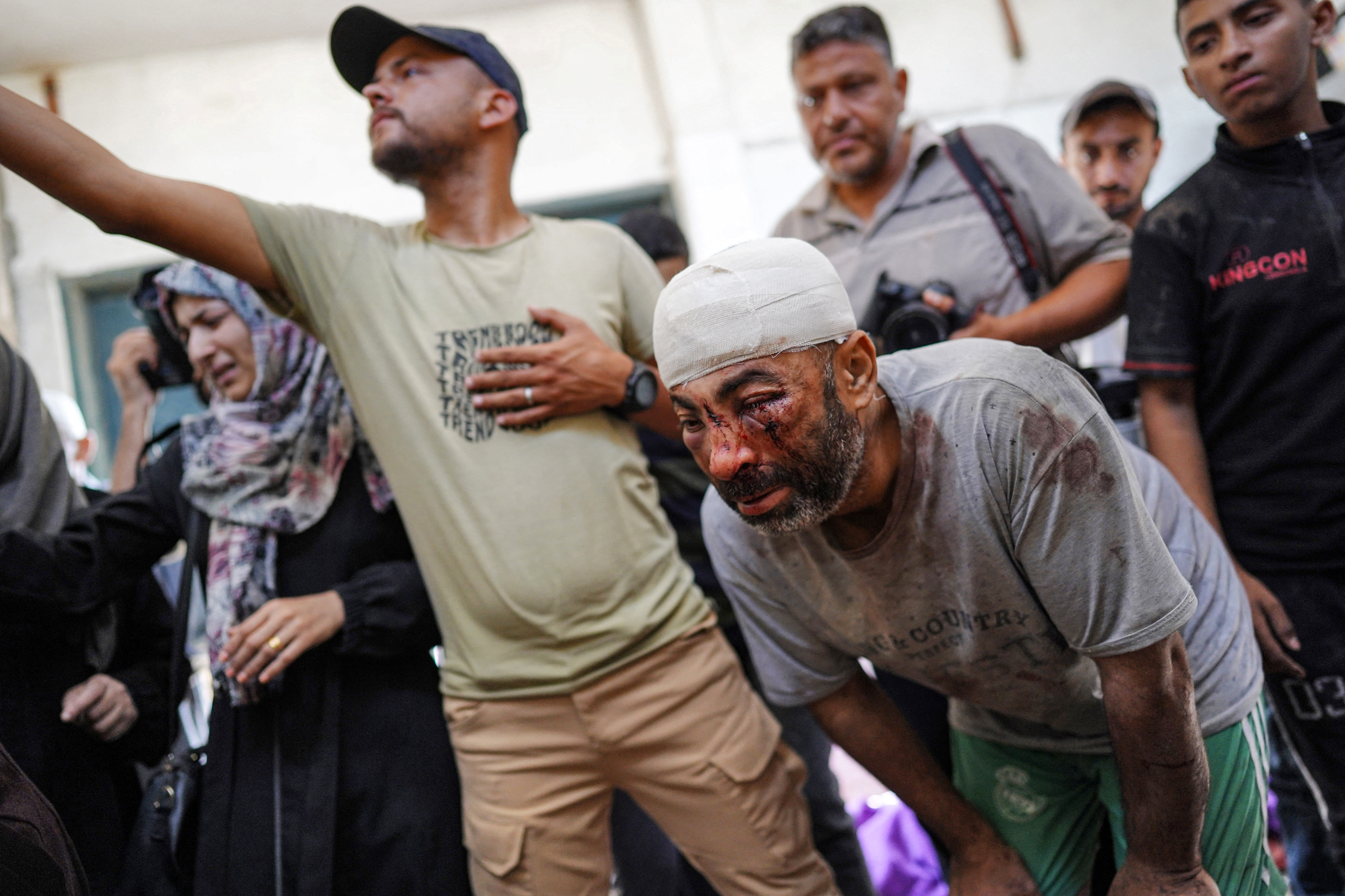 An injured man reacts as he mourns with others gathering to inspect the bodies of their family members who were killed in the aftermath of overnight Israeli bombardment in al-Maghazi