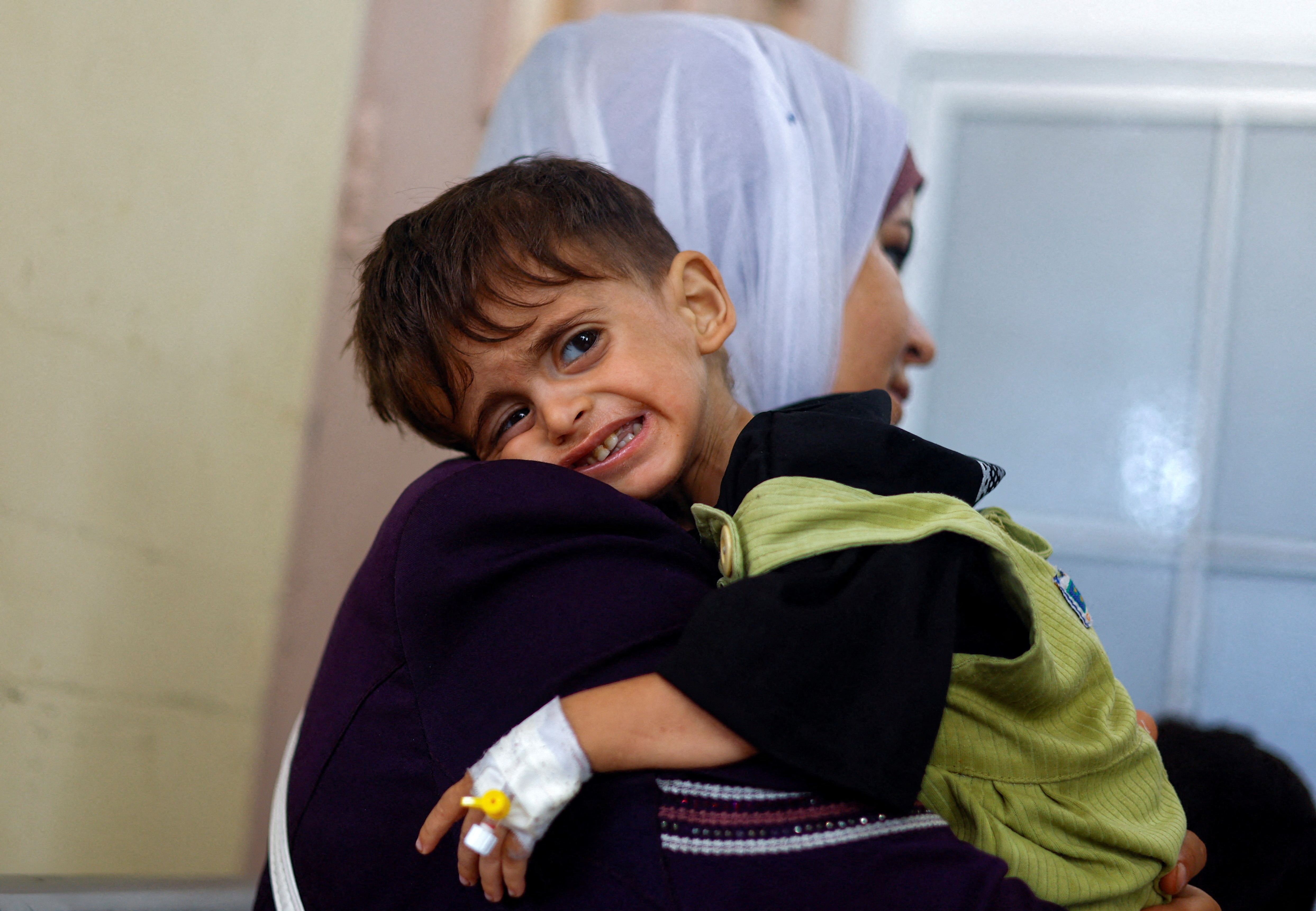 A Palestinian boy, Amjad Al-Kanoo, who suffers from malnutrition is held by his mother, Nada, as they wait to be transferred for treatment outside Gaza, amid Israel-Hamas conflict, at Nasser hospital in Khan Younis in the southern Gaza Strip June 24, 2024. REUTERS/Mohammed Salem TPX IMAGES OF THE DAY