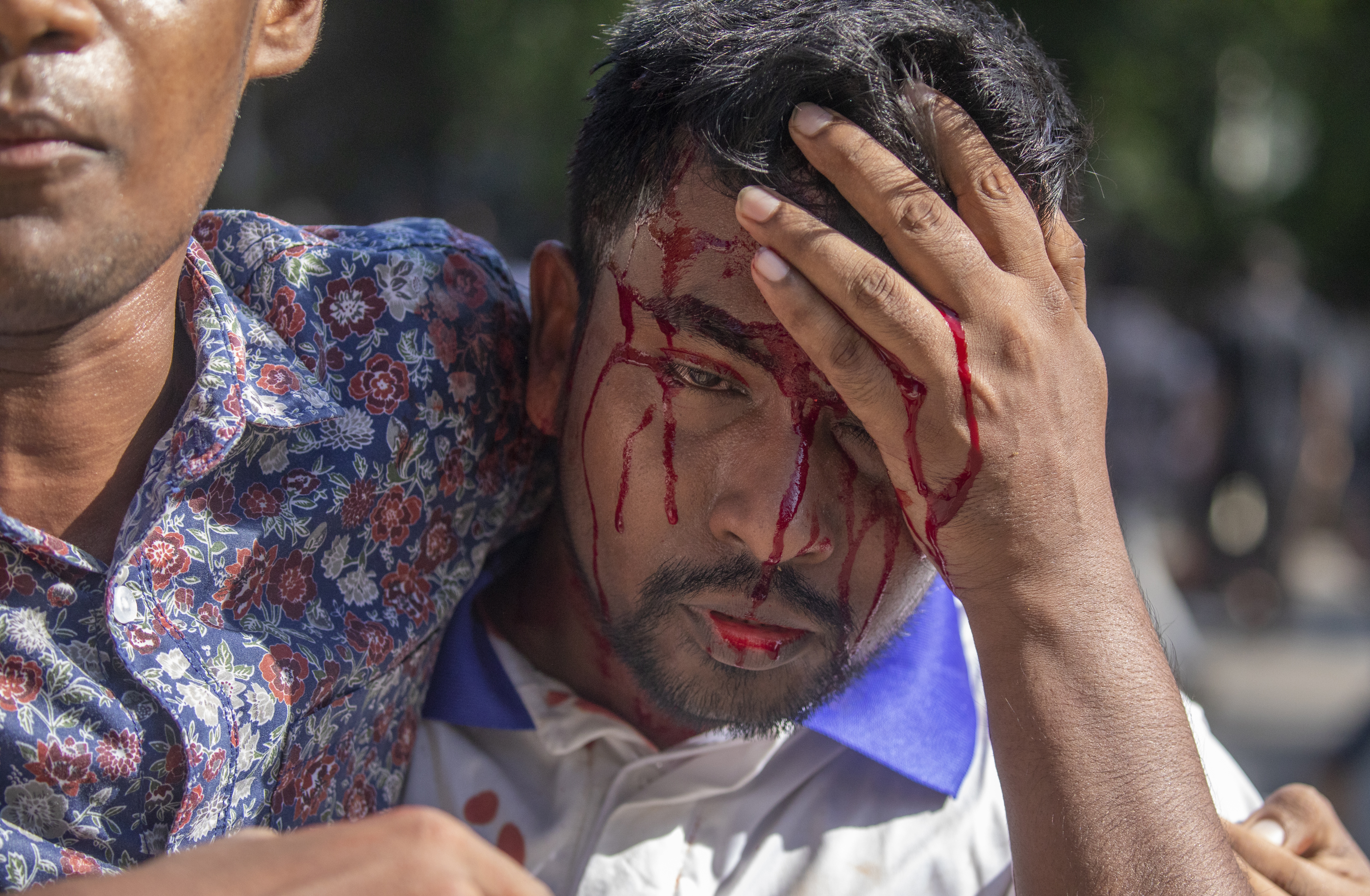 Violent clashes leave scores injured in Bangladesh