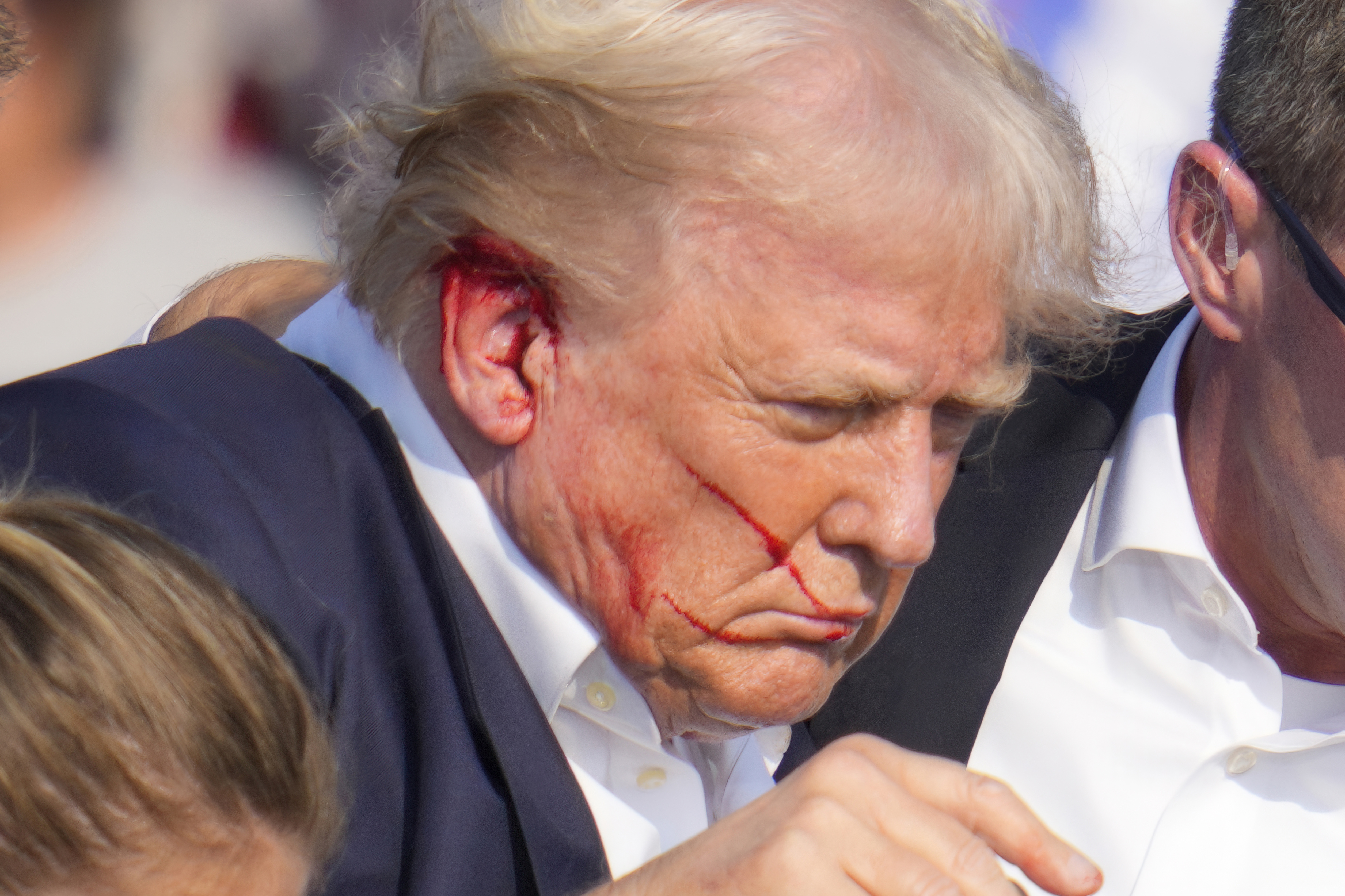Bloodied Trump survives assassination bid
