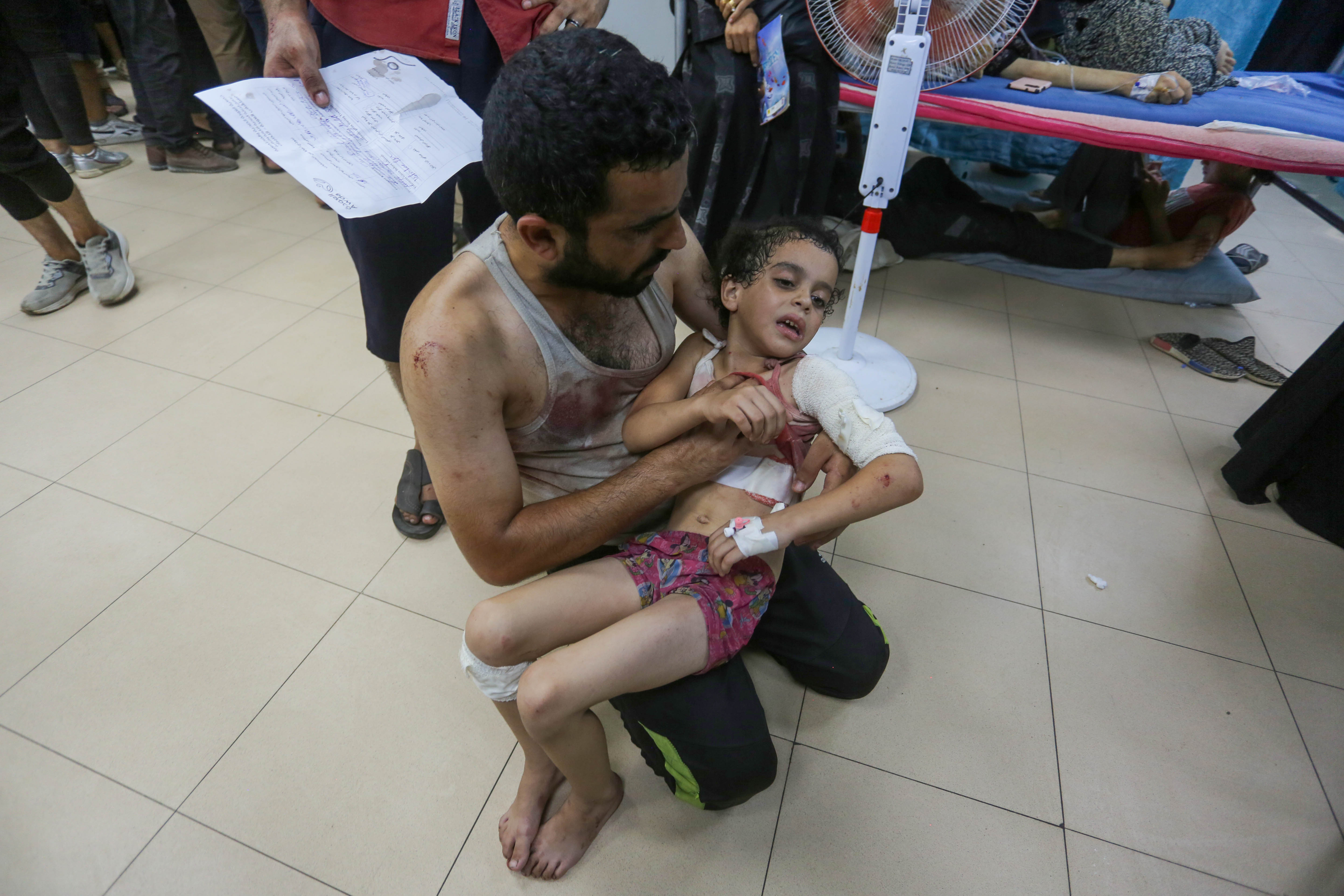 Injured Palestinians including children are brought to al-Aqsa Martyrs Hospital for medical treatment after the Israeli attacks hit Nuseirat Refugee Camp in the central Gaza Strip