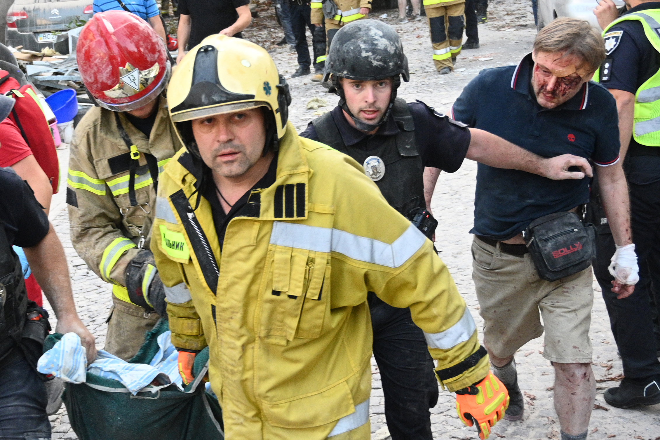 Rescuers carry the body of a girl killed in Russia's attack on Lviv. There are four rescuers, each carrying a corner of the stretcher in which she is being carried. Her father i walking alongside. His face is covered in blood and his hand is bandaged. There are spots of blood on his shorts and on his legs