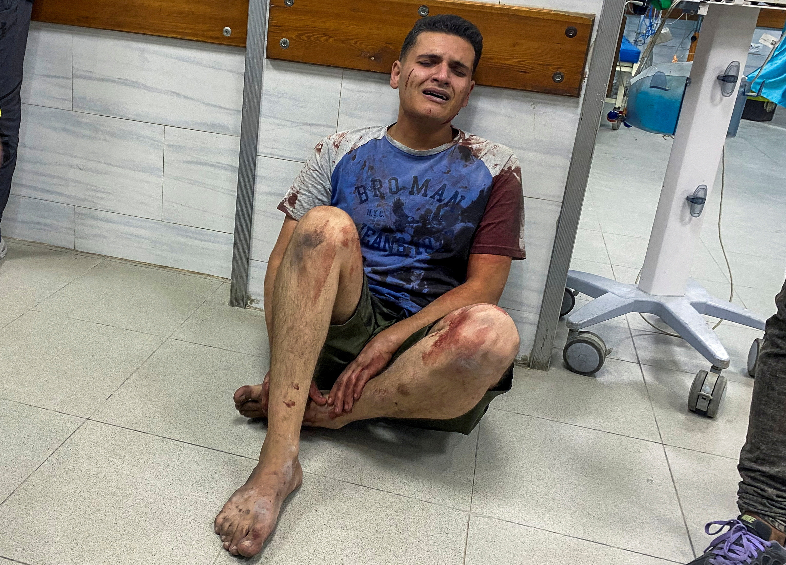 A Palestinian man wounded in an Israeli strike reacts as he sits on the floor at a hospital, amid the ongoing conflict between Israel and Hamas, in Jabalia,