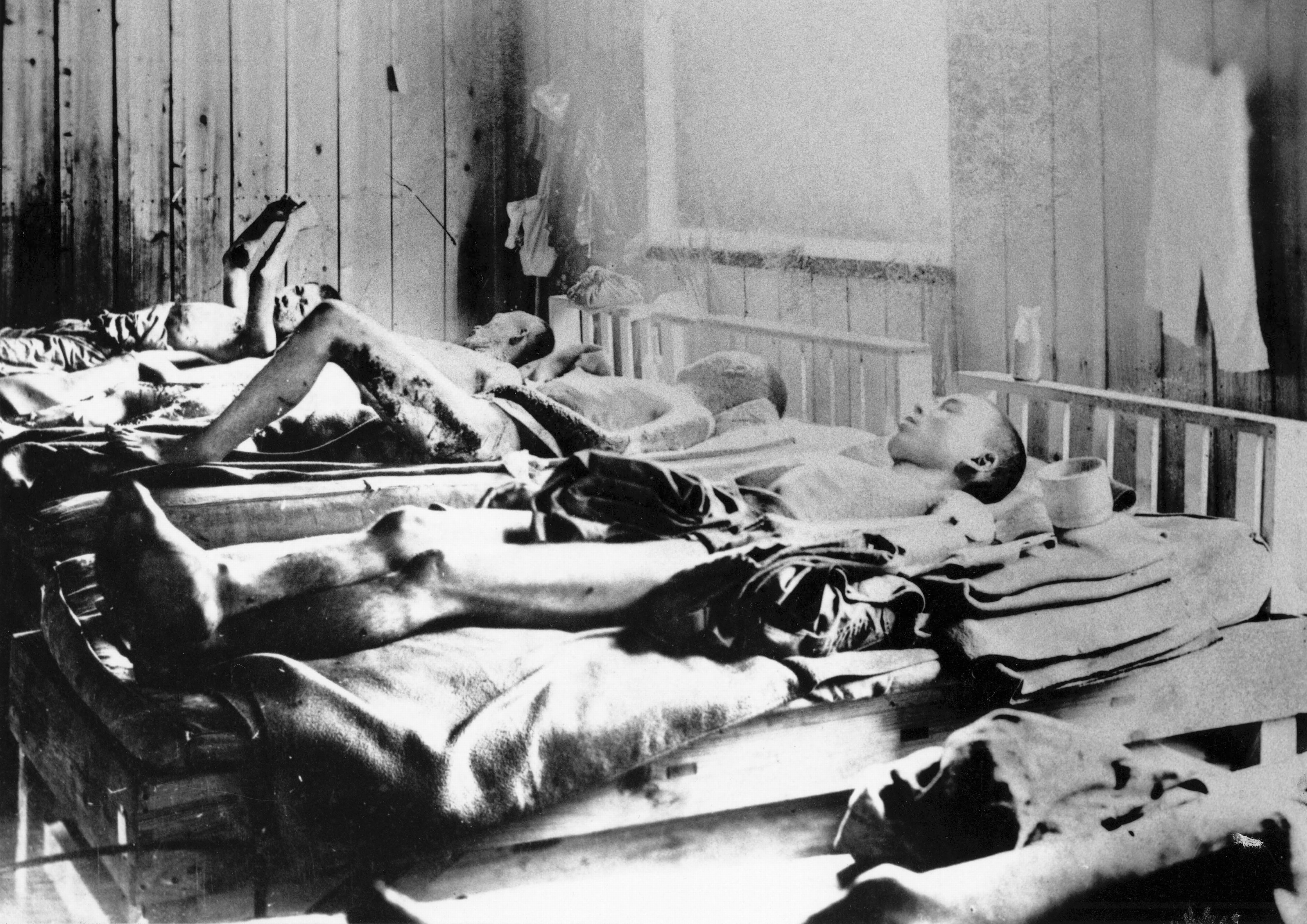 Hiroshima victims in a medical facility