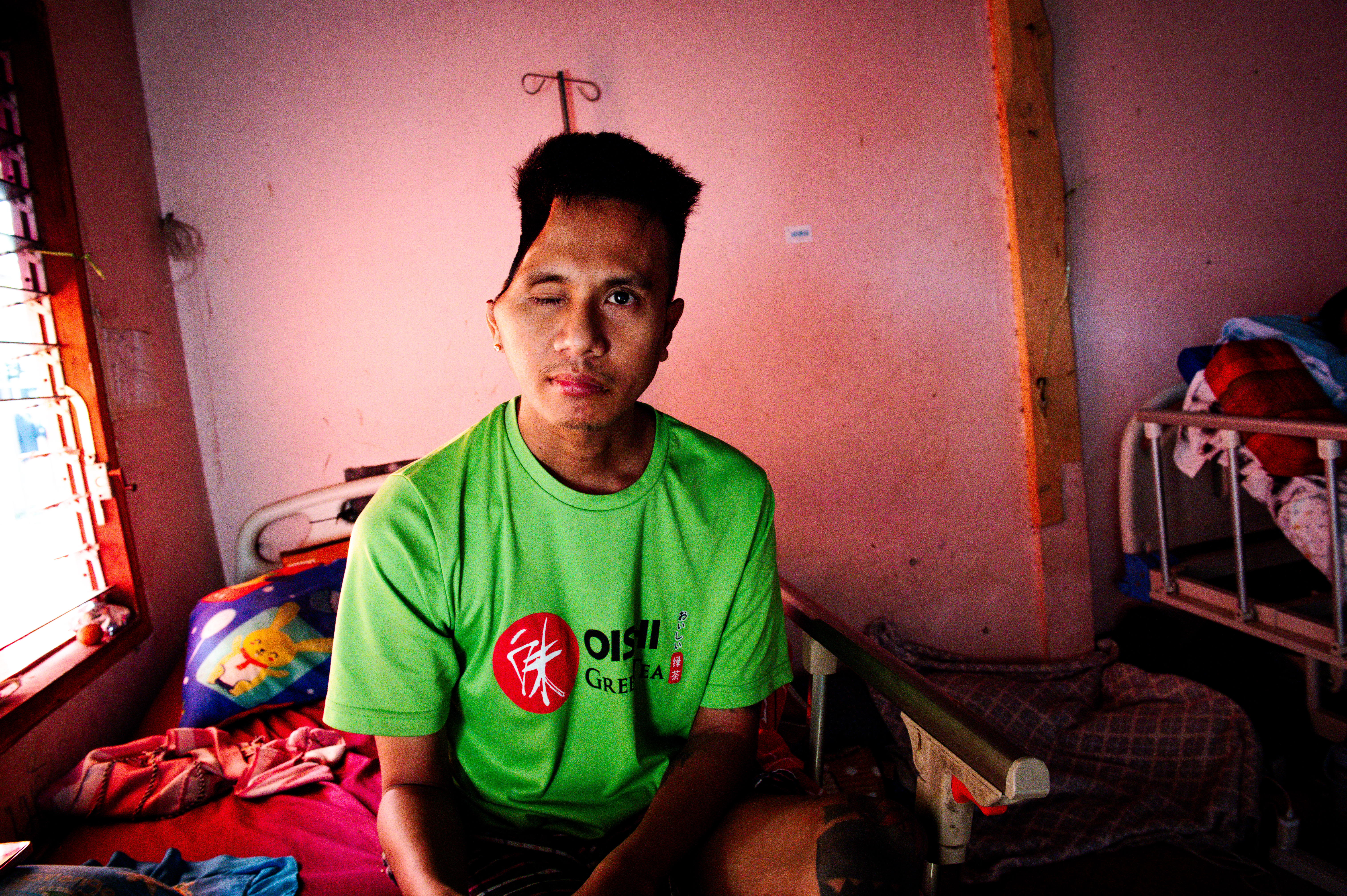 Pan Pan, 30, was severely injured when hit in the head by a sniper’s bullet. He has lost sight in his right eye and suffers from fainting [Ali MC/Al Jazeera]