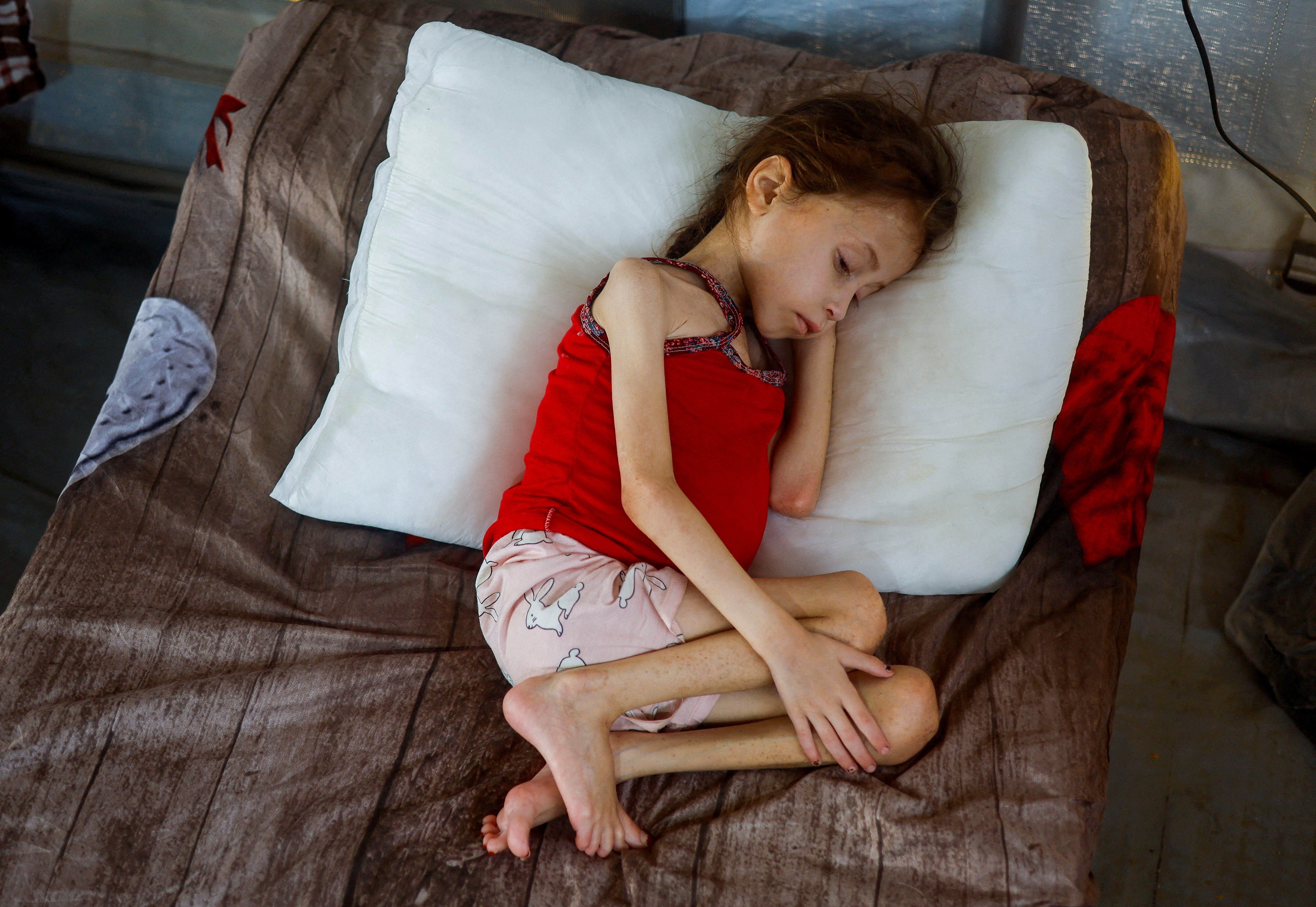 FILE PHOTO: Jana Ayad, a malnourished Palestinian girl, rests on a bed as she receives treatment at the International Medical Corps field hospital, amid the Israel-Hamas conflict, in Deir Al-Balah in the southern Gaza Strip, June 22, 2024. REUTERS/Mohammed Salem/File Photo