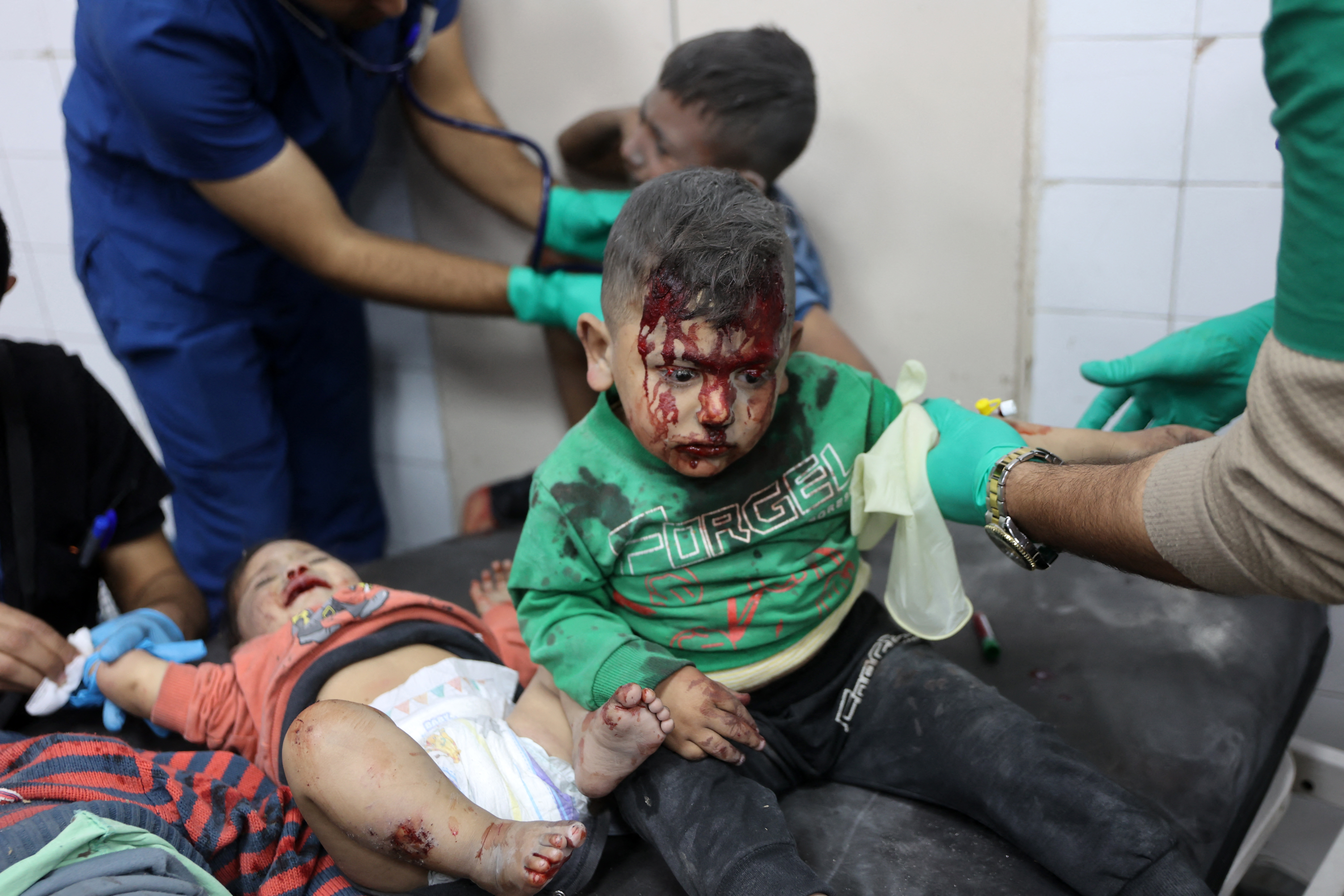 Injured Palestinian children and a baby receive medical treatment at the al-Ahli Arab Hospital.