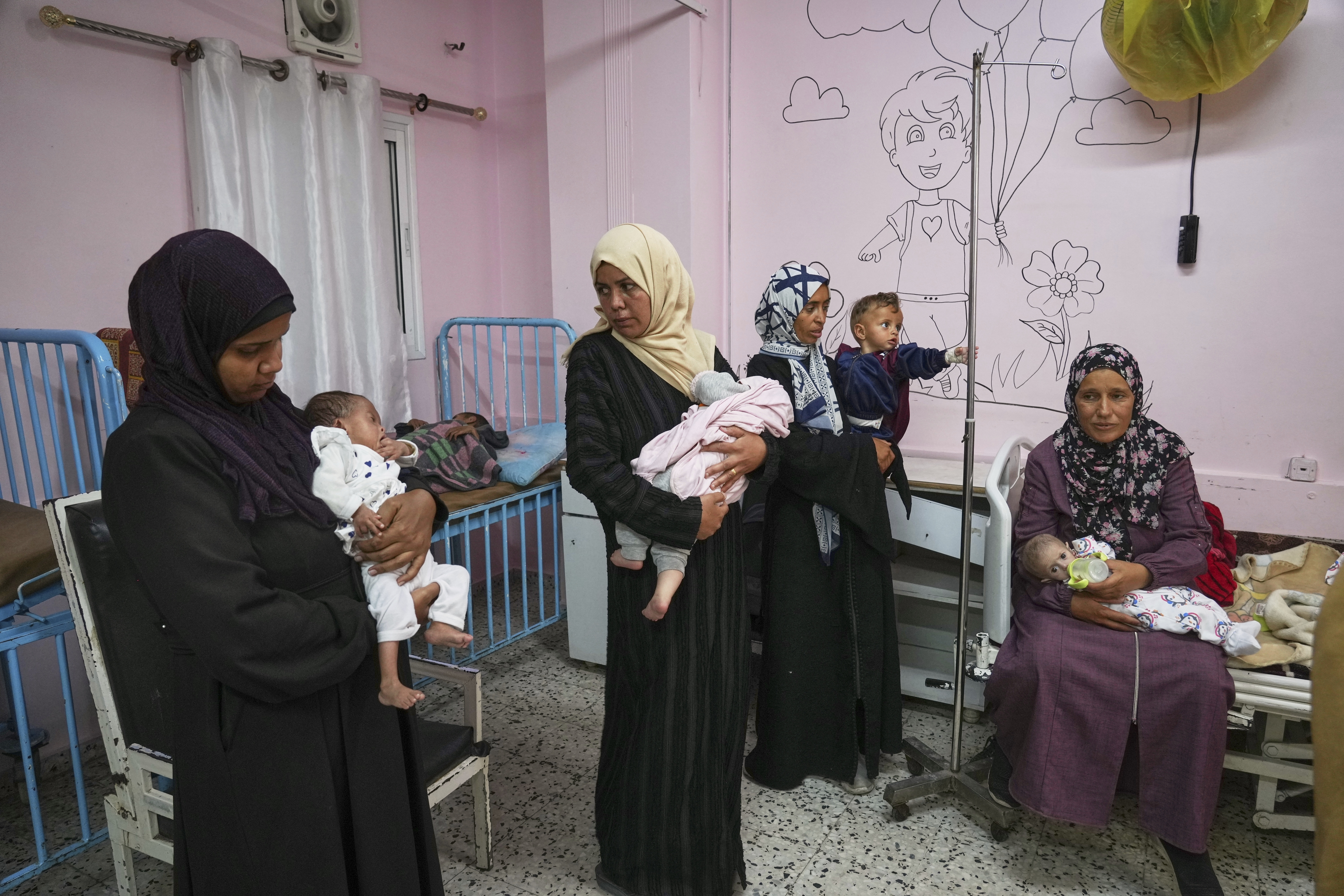 Mideast Wars Malnourished Children