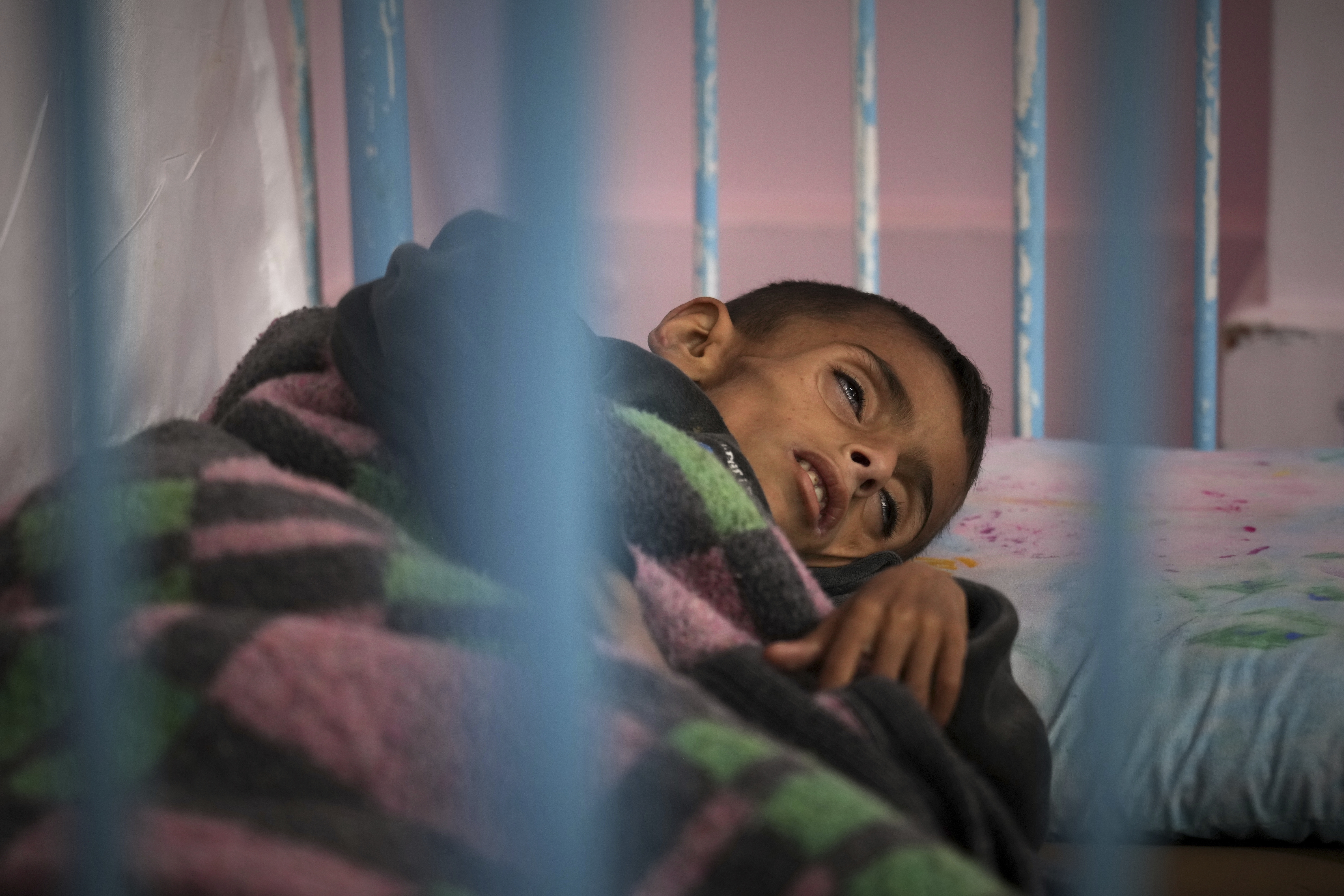 Osama al-Raqab, 5, whose mother says his cystic fibrosis has worsened since the start of the war due to the lack of meat, fish and enzyme tablets to help him digest food, at the malnutrition clinic in Nasser Hospital, Khan Younis, Gaza, on Thursday, May 1, 2025