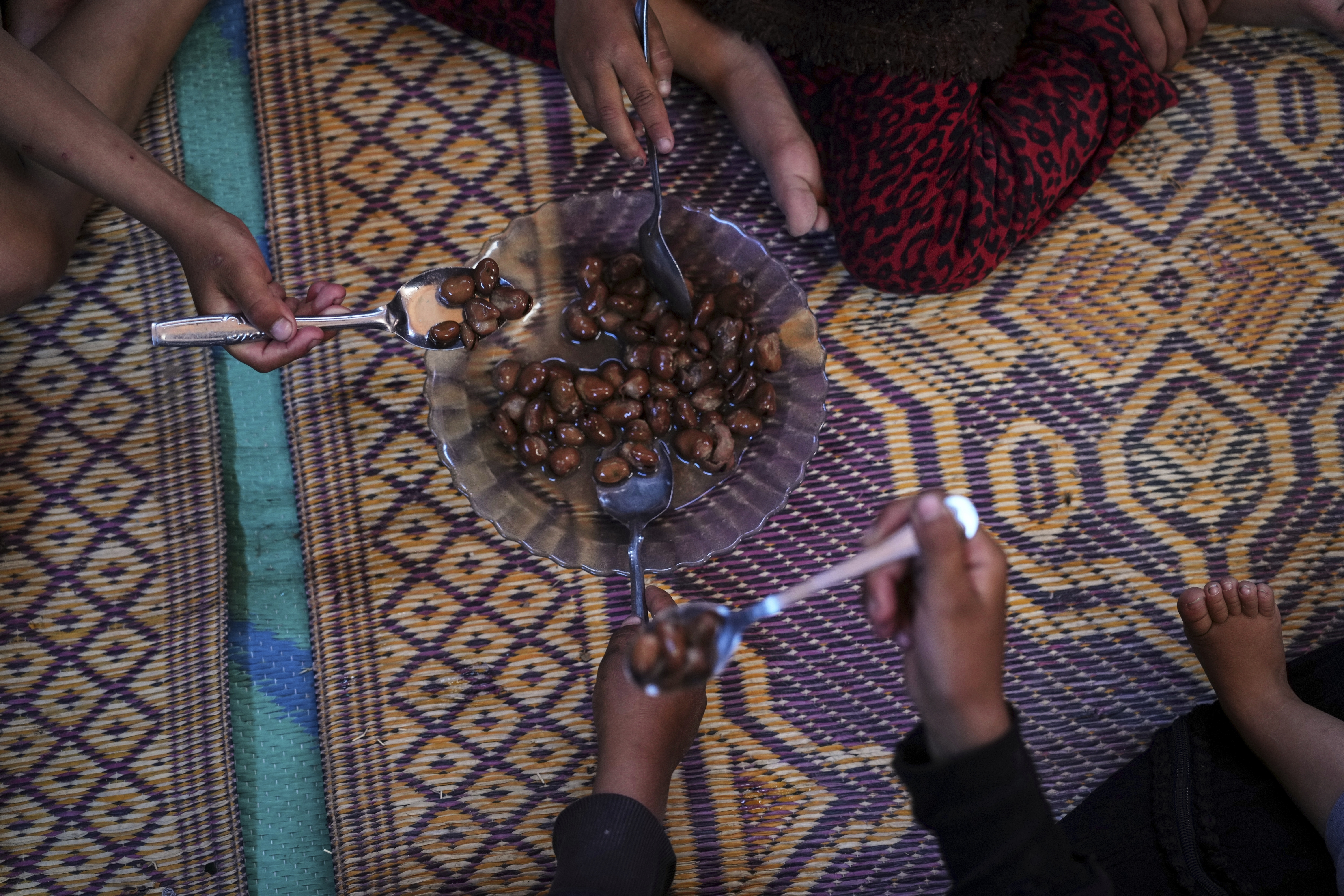 Mideast Wars Malnourished Children