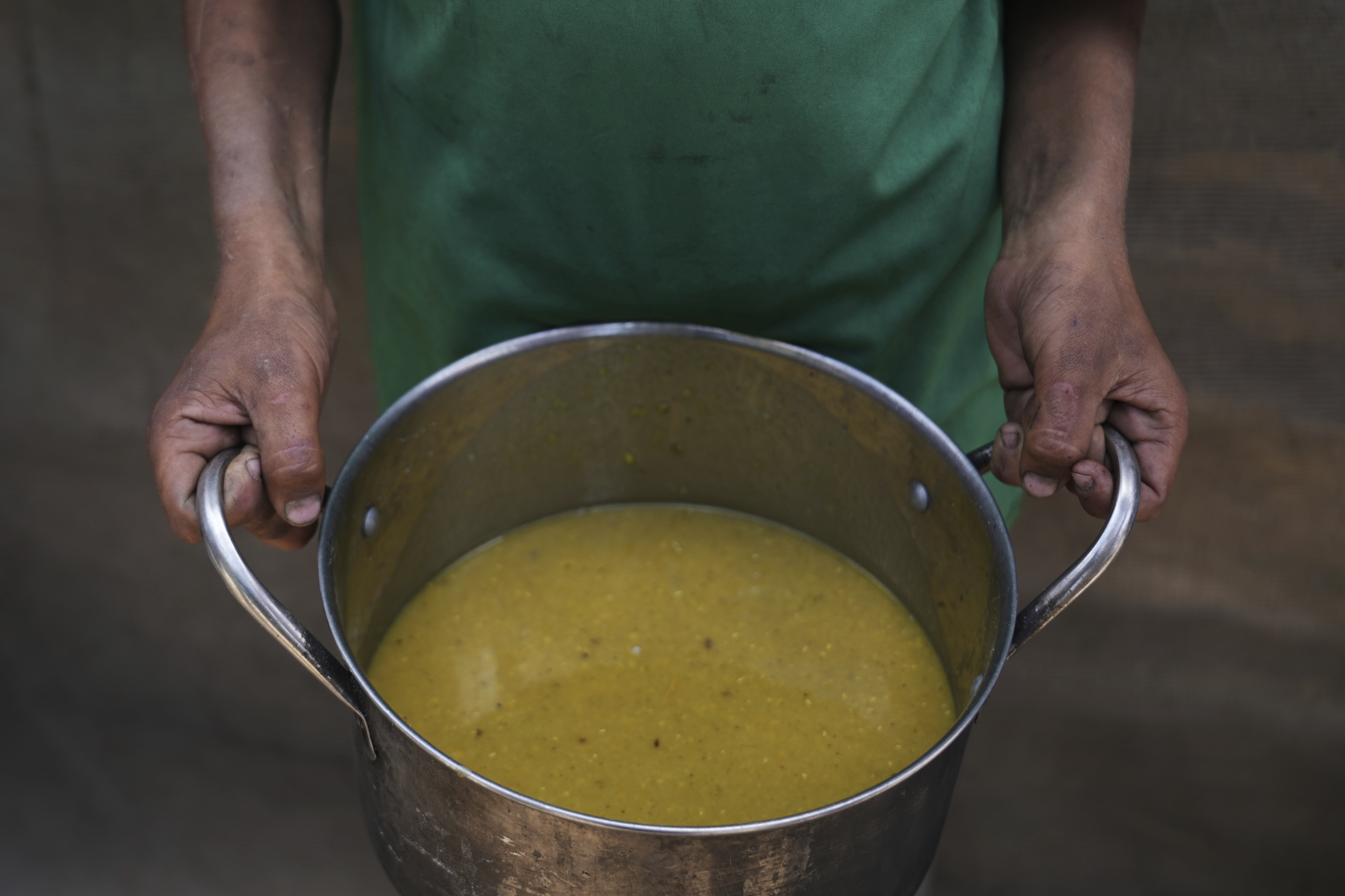 Mideast Wars Malnourished Children