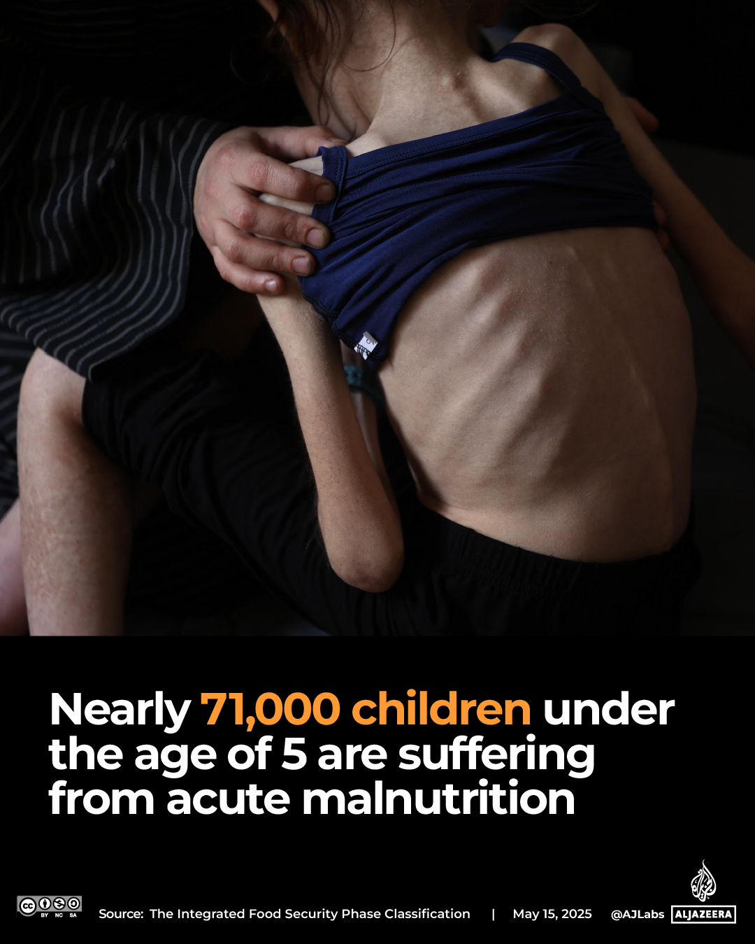 Interactive_Gaza_food_IPC_report_May13_2025-Gaza children acute malnutrition