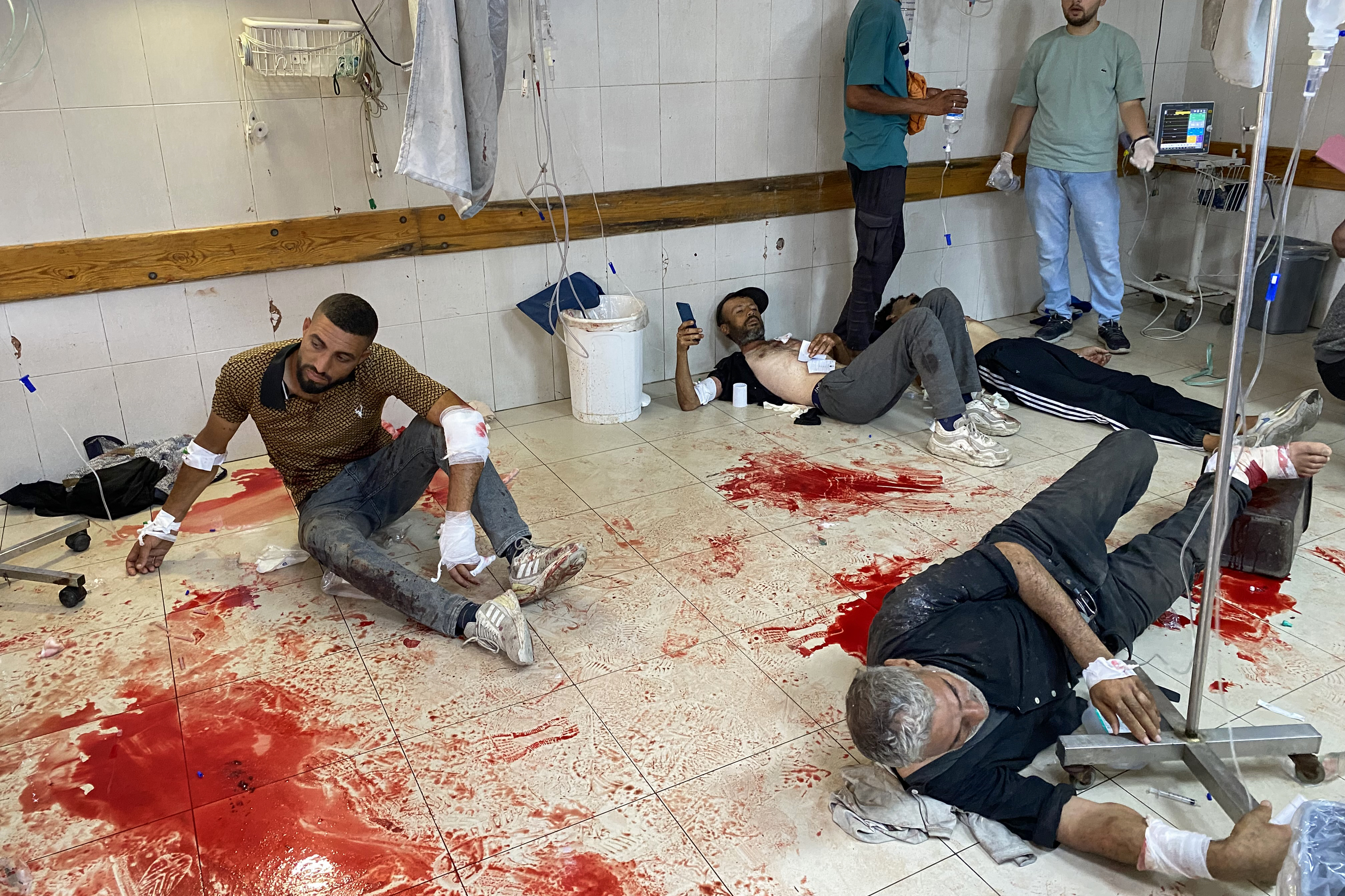 Palestinians who were injured in Israeli fire as they gathered near a food aid centre, receive care at Khan Yunis' Nasser hospital in the southern Gaza Strip on June 17, 2025. Gaza's civil defence agency said Israeli forces killed at least 47 people and wounded more than 200, as thousands of Palestinians gathered to receive flour at an aid centre in the morning, adding "Israeli drones fired at the citizens... some minutes later, Israeli tanks fired several shells at the citizens, which led to a large number of martyrs and wounded"[Unknown/AFP]