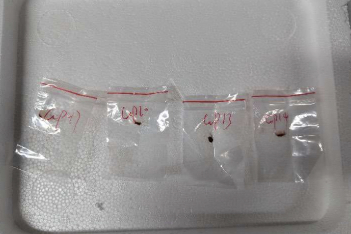 This image provided by United States District Court For The Eastern District Of Michigan shows toxic plant pathogens that a Chinese scientist entered the U.S. last year stashed in his backpack, federal authorities said Tuesday, June 3, 2025, as they filed charges against him and a girlfriend who worked in a lab at the University of Michigan. (United States District Court For The Eastern District Of Michigan via AP) A