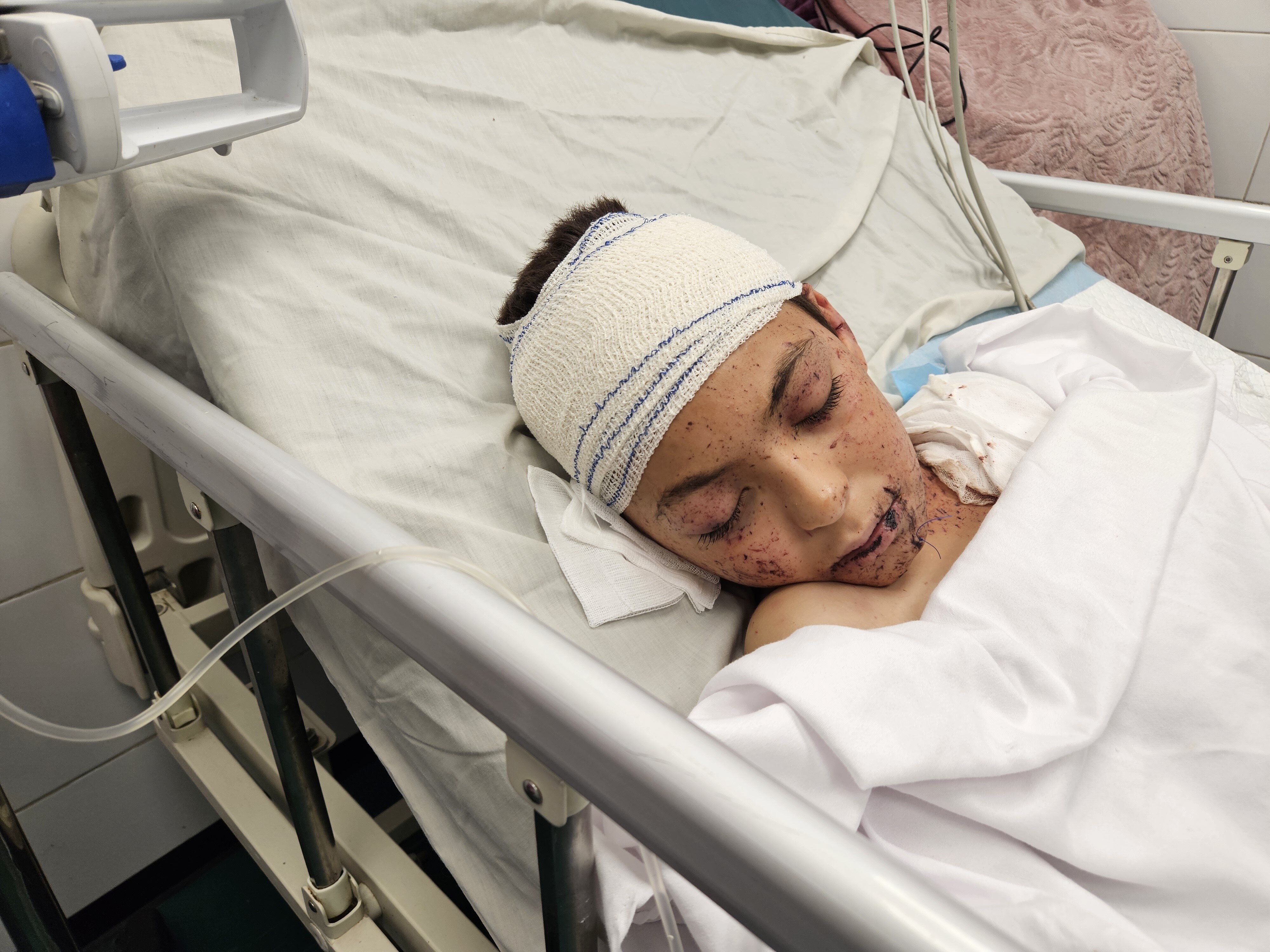 KHAN YUNIS, GAZA - MAY 24: A wounded Palestinian child, the only surviving child of doctor Ela al-Najjar, lies in a hospital bed at Nasser Hospital in Khan Yunis after an Israeli airstrike hit their home. Al-Najjar lost 9 of her 10 children in the attack, which occurred shortly after she had left for work. (Photo by Hani Alshaer/Anadolu via Getty Images)