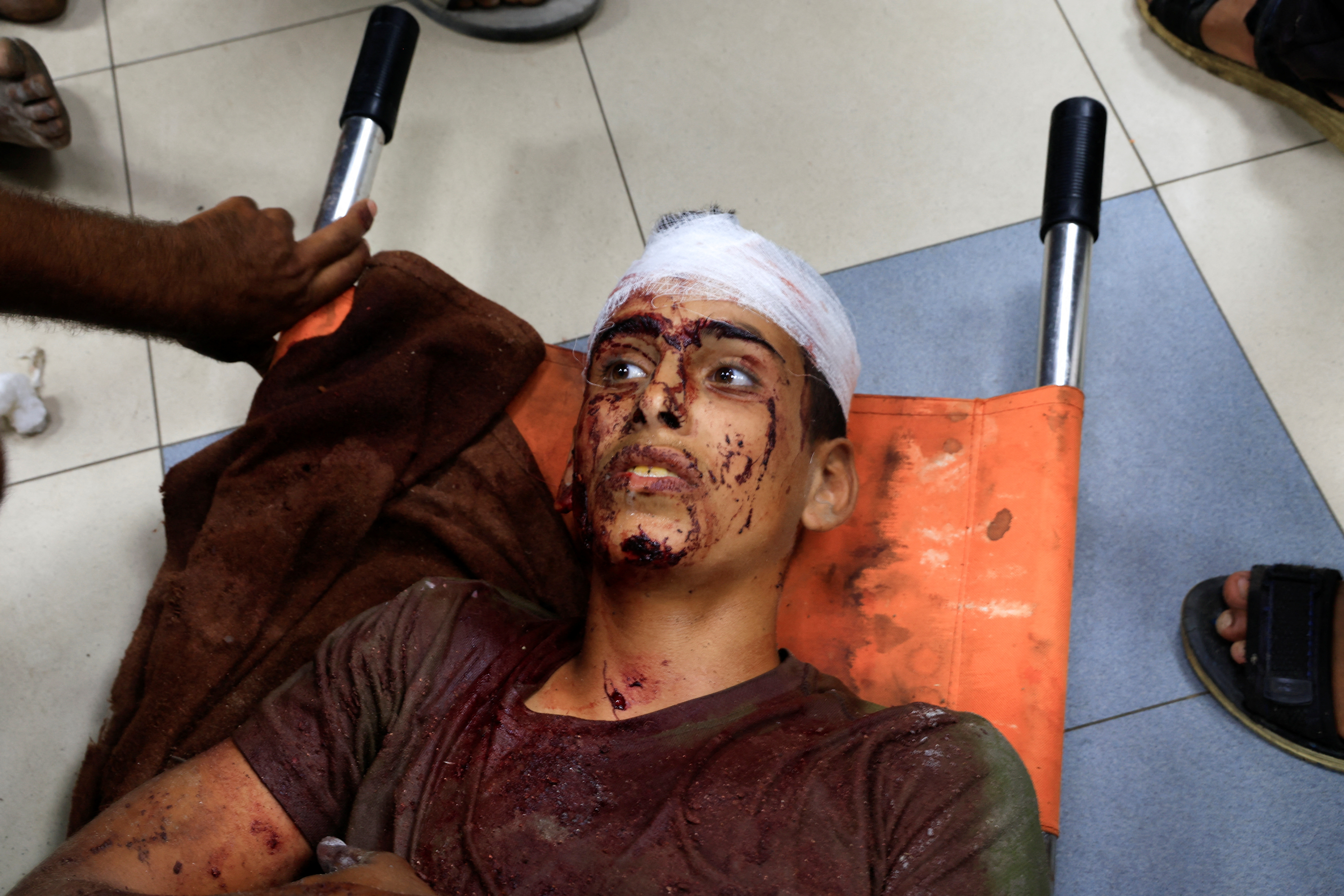 A Palestinian, wounded by Israeli fire while seeking aid receives treatment at Nasser Hospital in Khan Younis, southern Gaza Strip, July 3, 2025. [Hatem Khaled/Reuters]