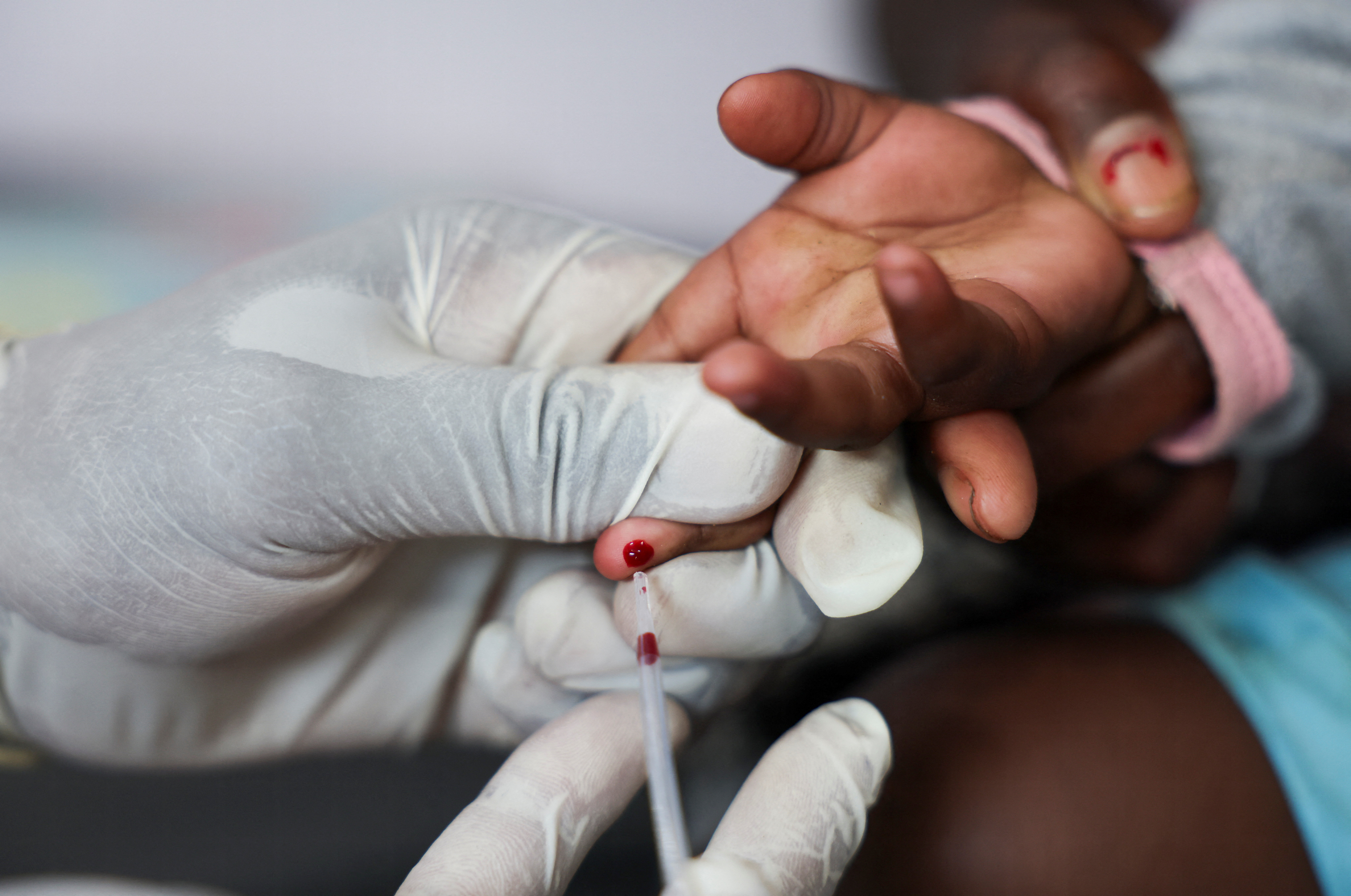A nurse takes a blood sample from a child for an HIV test, at a clinic in Diepsloot, north of Johannesburg, South Africa
