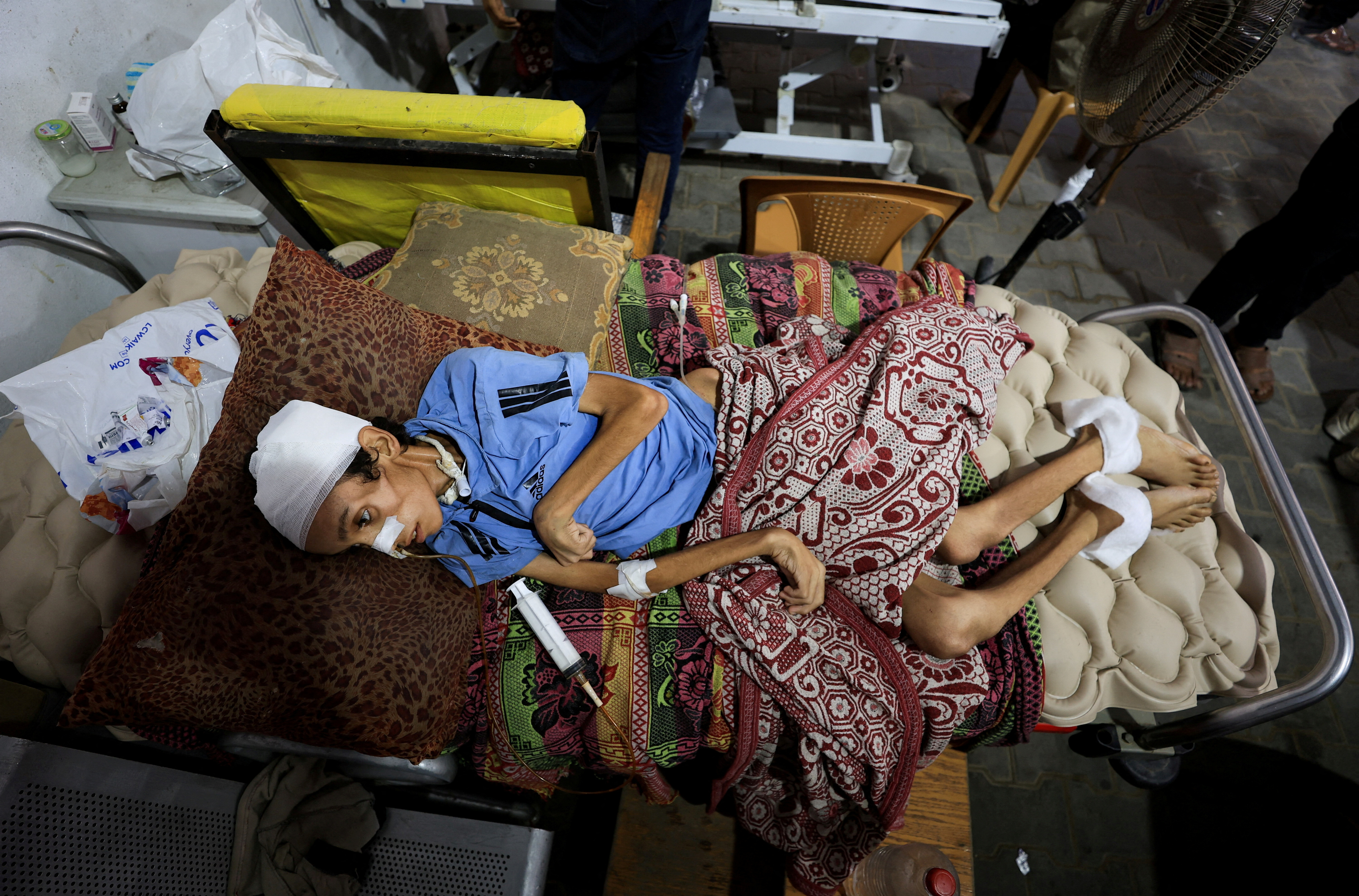 Palestinian boy Mosab Al-Debs, 14, who is malnourished according to medics, lies on a bed at Al-Shifa Hospital in Gaza City, July 22, 2025.