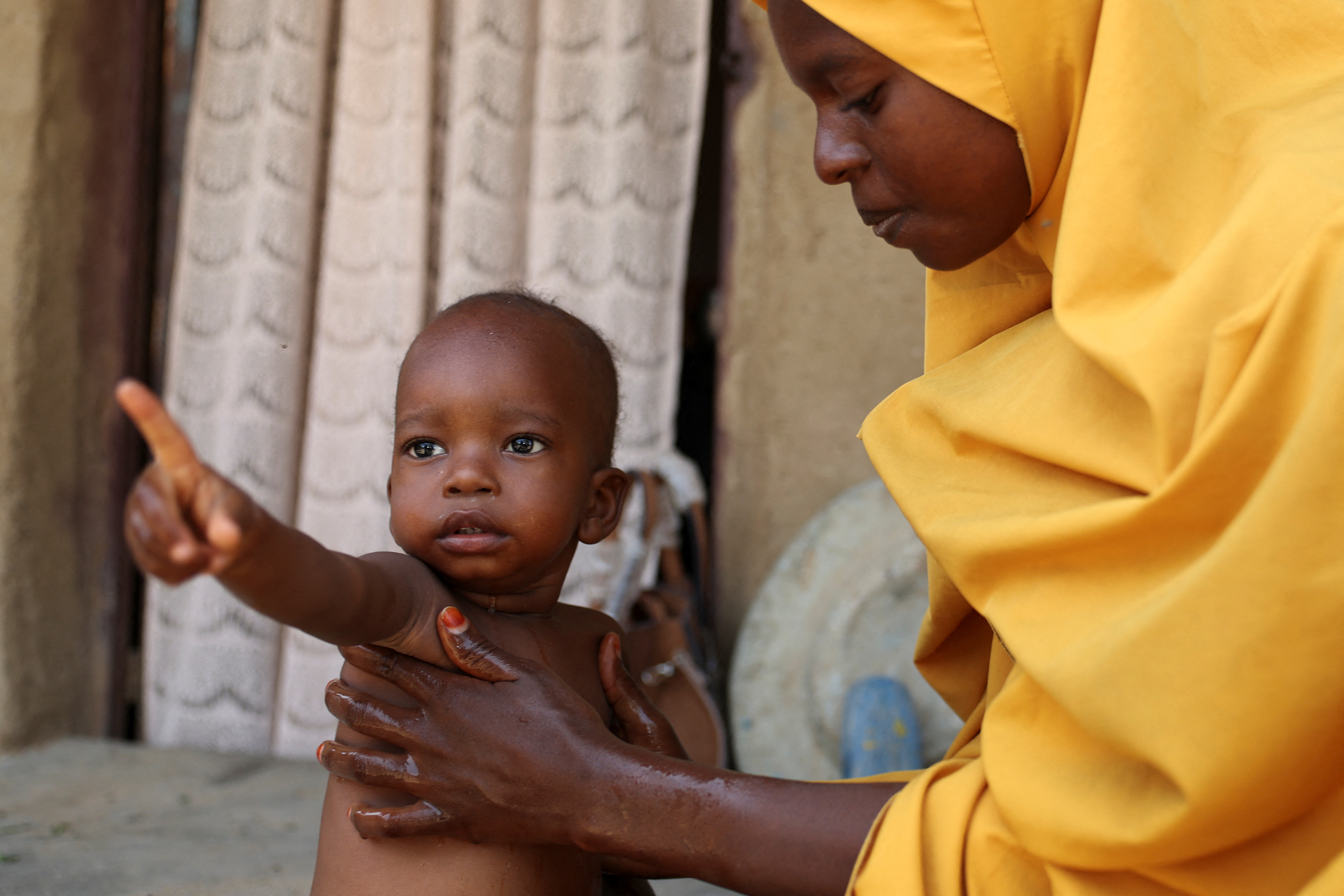 A mother tends to her sick child, suffering from malnutrition in Nigeria