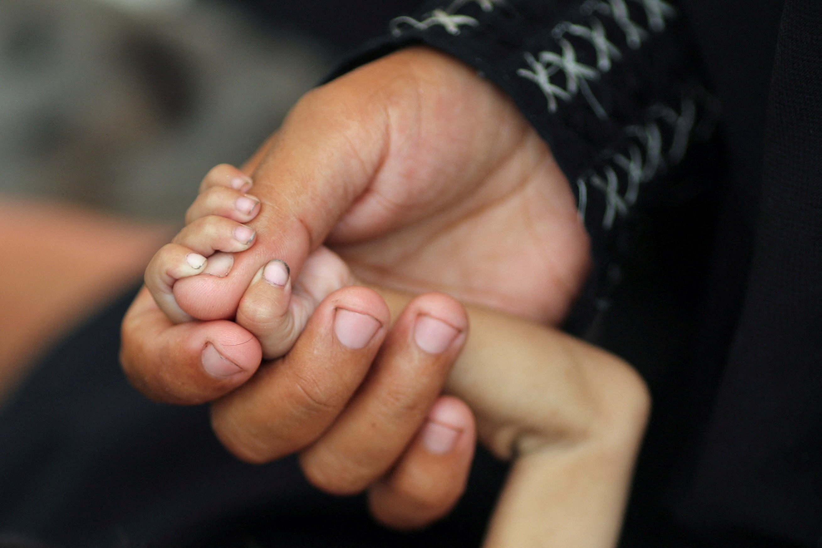 Palestinian mother Amira Muteir holds the hand of her five-month-old baby Ammar, whom she says is wasting away from malnutrition, in Gaza City, August 5, 2025. [Mahmoud Issa/Reuters]