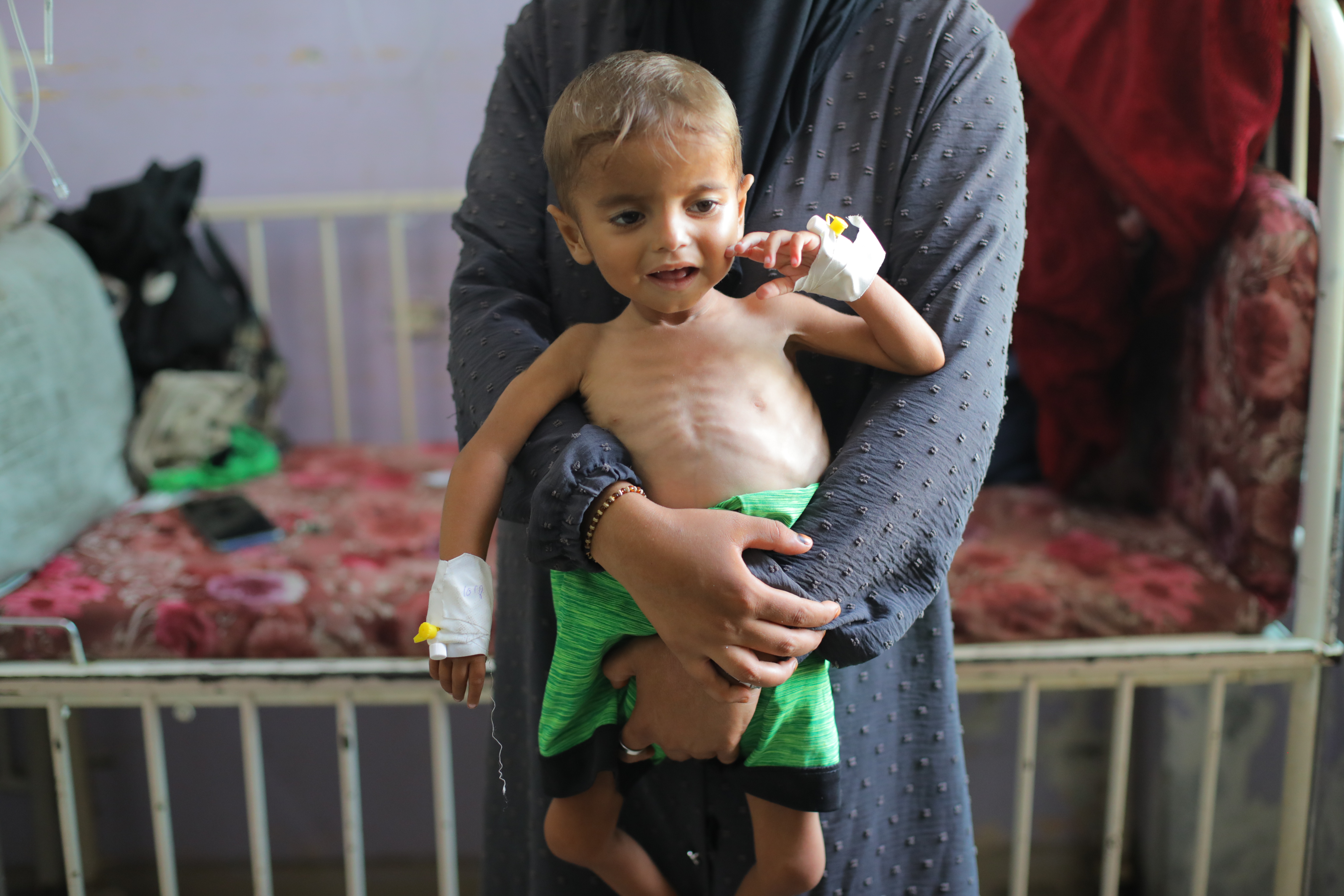 DEIR AL BALAH, GAZA - AUGUST 11: Children of various ages suffering from malnutrition are being treated with limited resources due to shortages of baby formula and medicine at Al-Aqsa Martyrs Hospital in Deir al-Balah, Gaza on August 11, 2025. Many Palestinians, especially children have died of malnutrition and starvation as the famine caused by Israeli blockade continues. ( Hassan Jedi - Anadolu Agency )