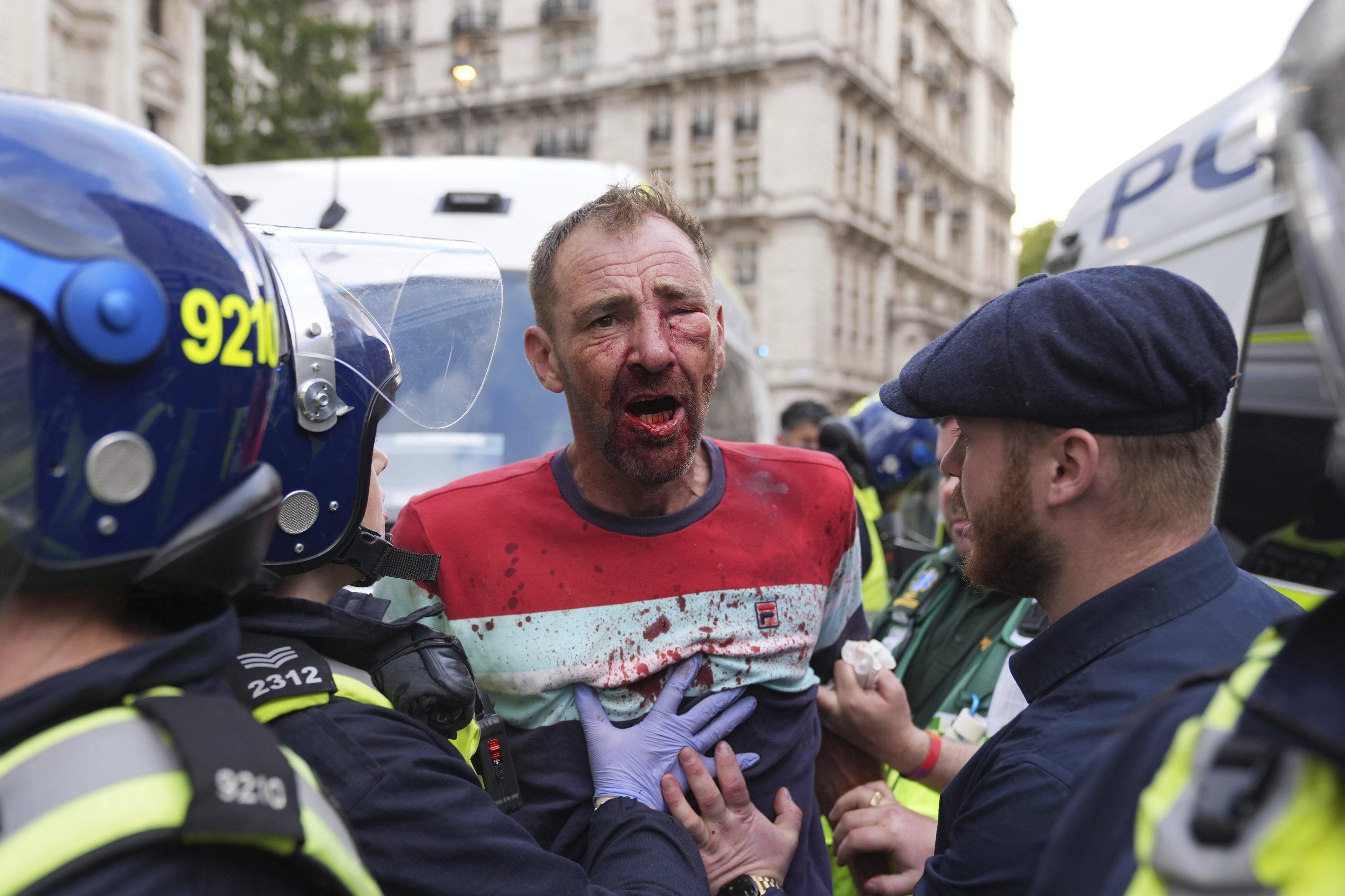 A person with a bloodied face and clothing confronts police officers during the Tommy Robinson-led Unite the Kingdom march and rally on Whitehall in central London, Saturday Sept. 13, 2025. (Lucy North/PA via AP)