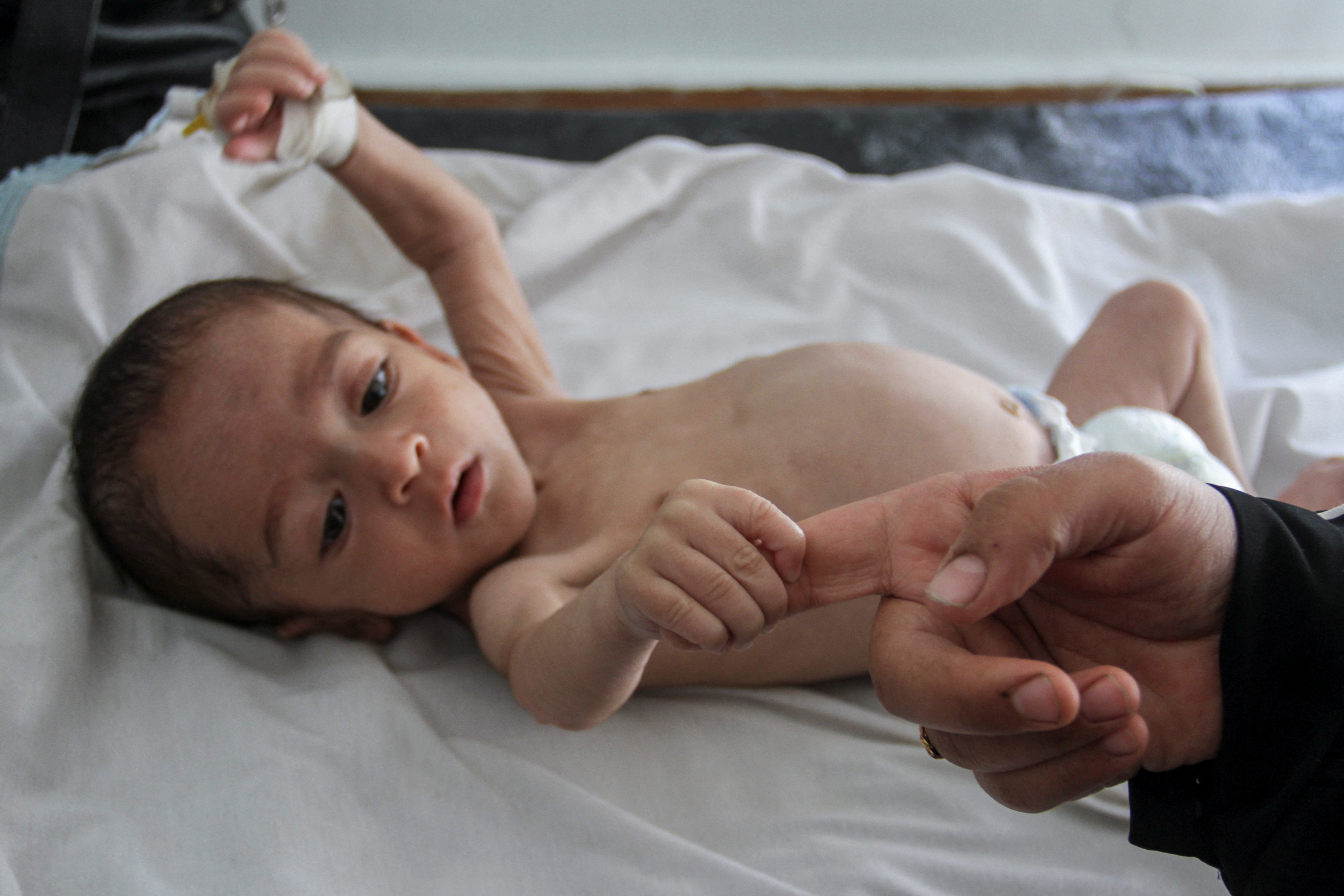 Palestinian woman Nisreen holds the hand of her son Majd Salem, a six-month-old malnourished Palestinian baby [Mahmoud Issa/Reuters]