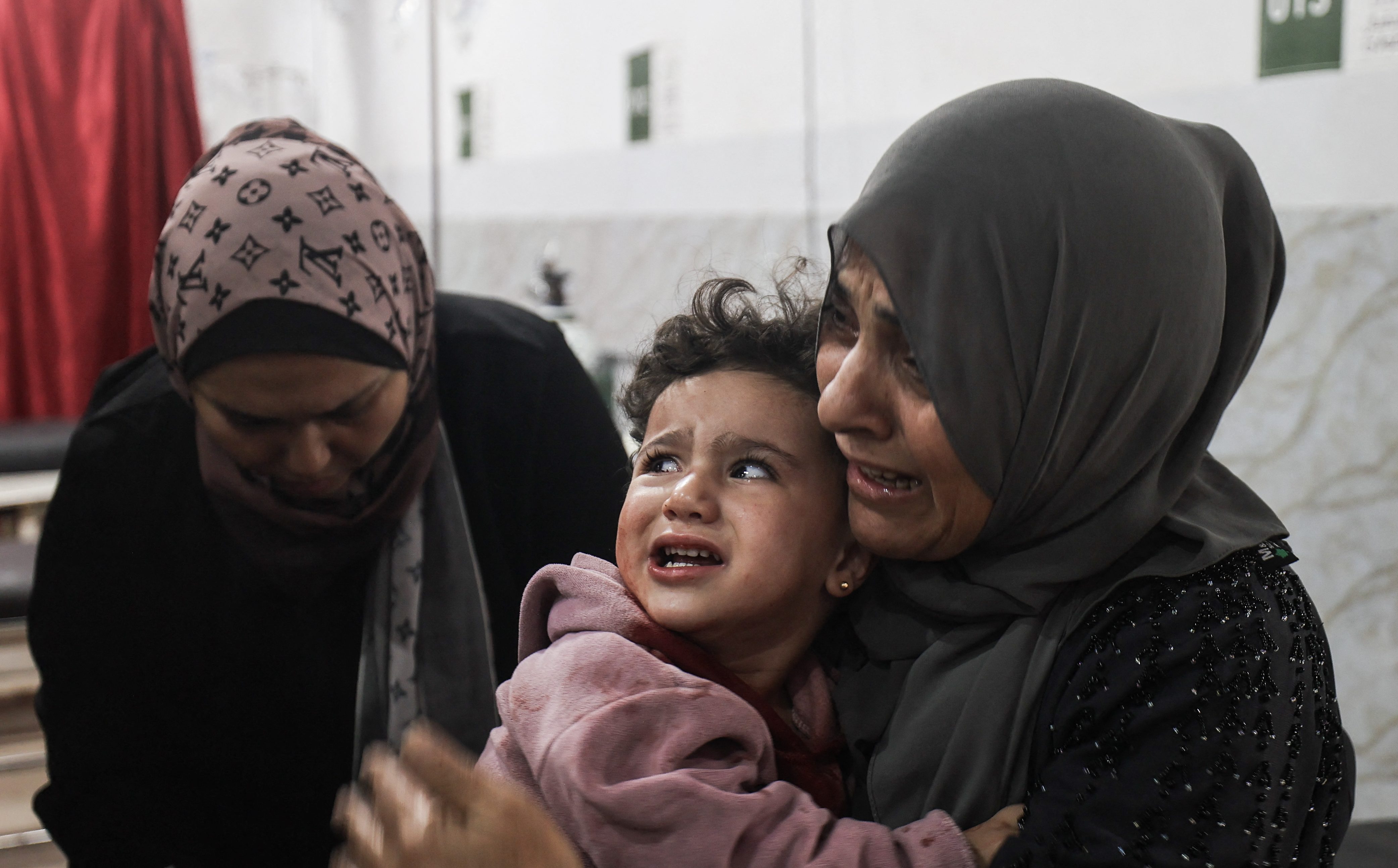 An injured Palestinian child reacts as it is held by its mother.