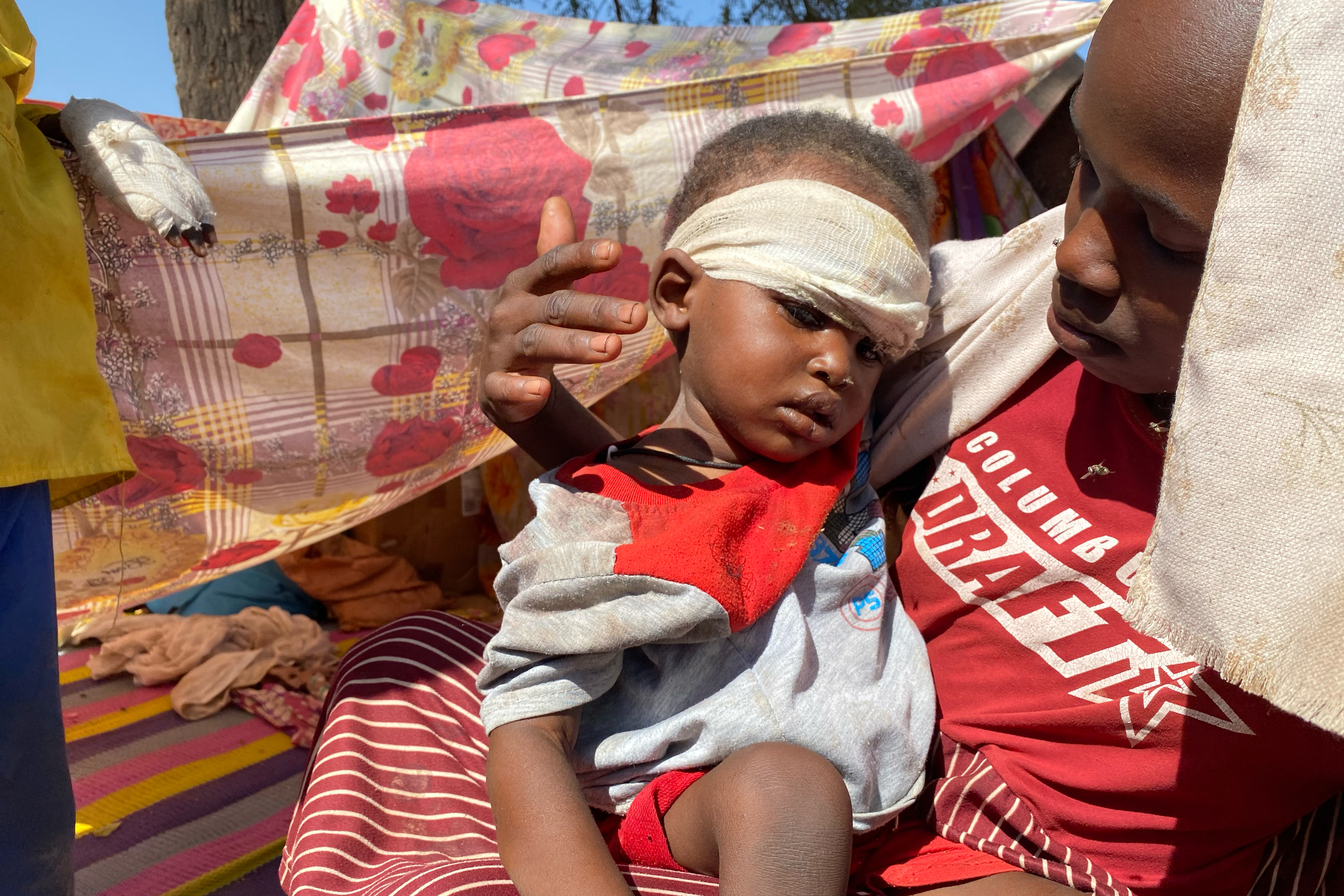 A Sudanese child receives medical treatment at a displacement camp.