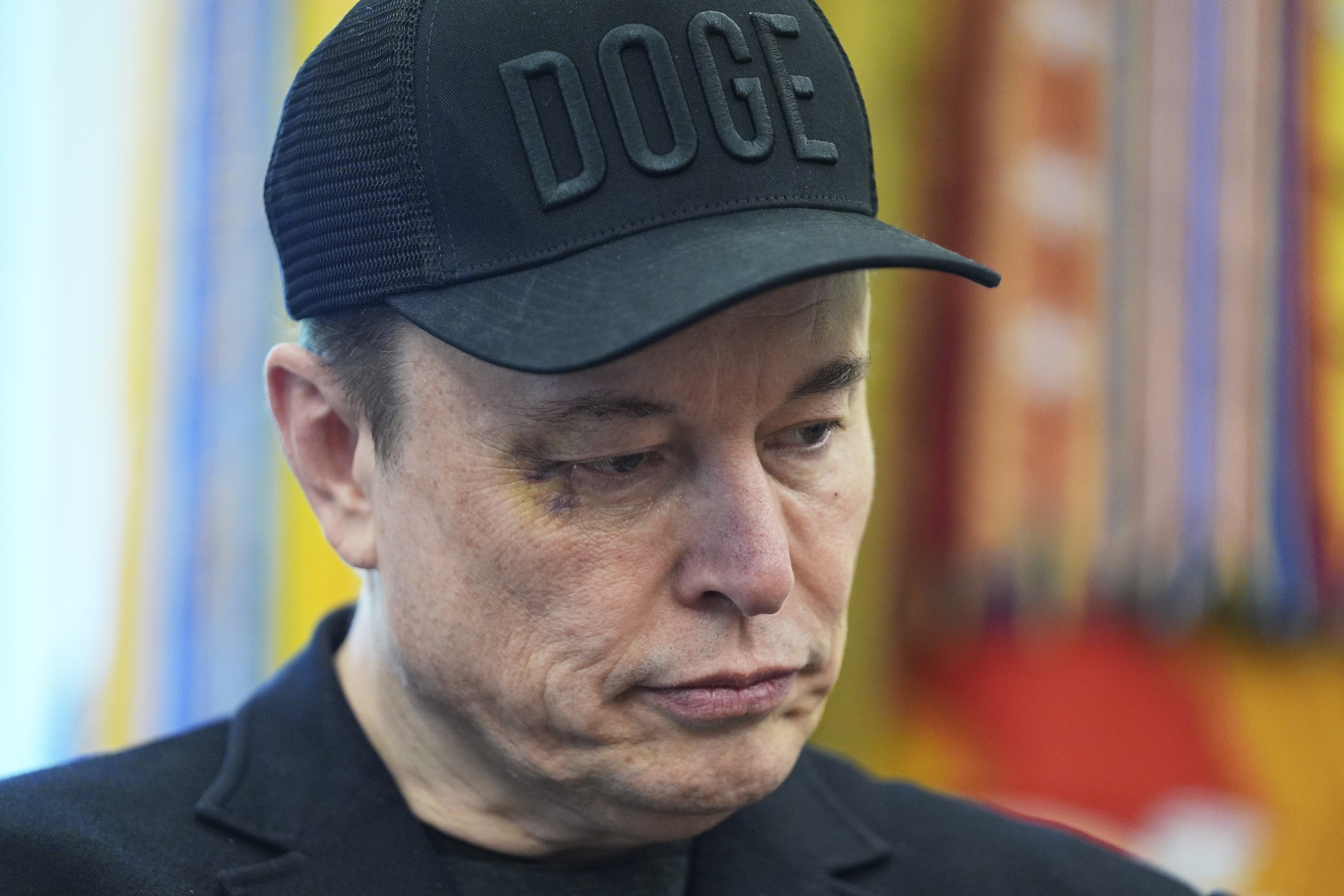 elon Musk with a black eye
