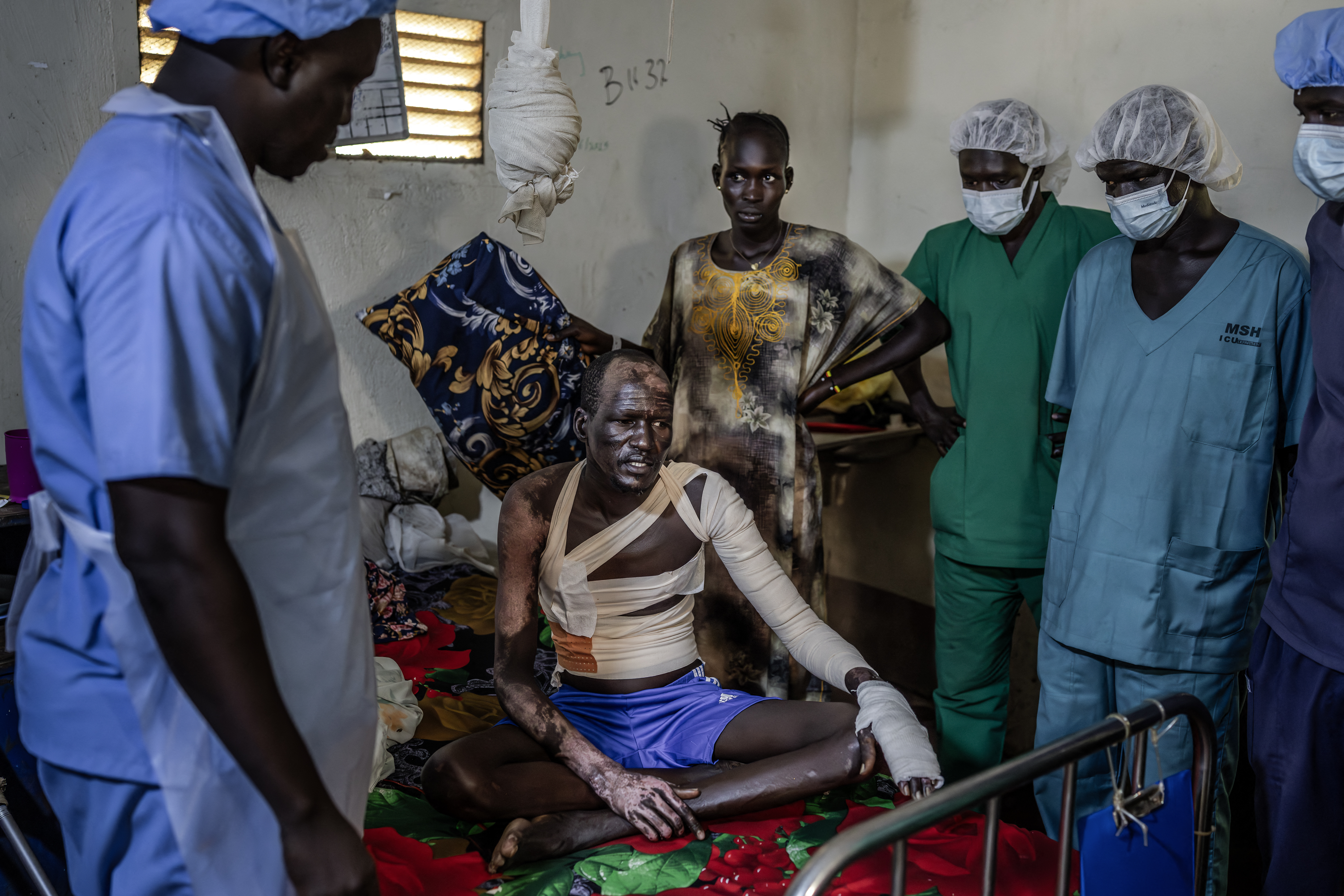Medical personnel check on Tot Khor, 41, (C) as he sits on a bed recovering from burns sustained during clashes between the South Sudan People’s Defence Forces (SSPDF) and the South Sudan People’s Liberation Army in Opposition (SPLA-IO) at Akobo Teaching Hospital in the strategic opposition-controlled town of Akobo, Jonglei State, on February 12, 2026.