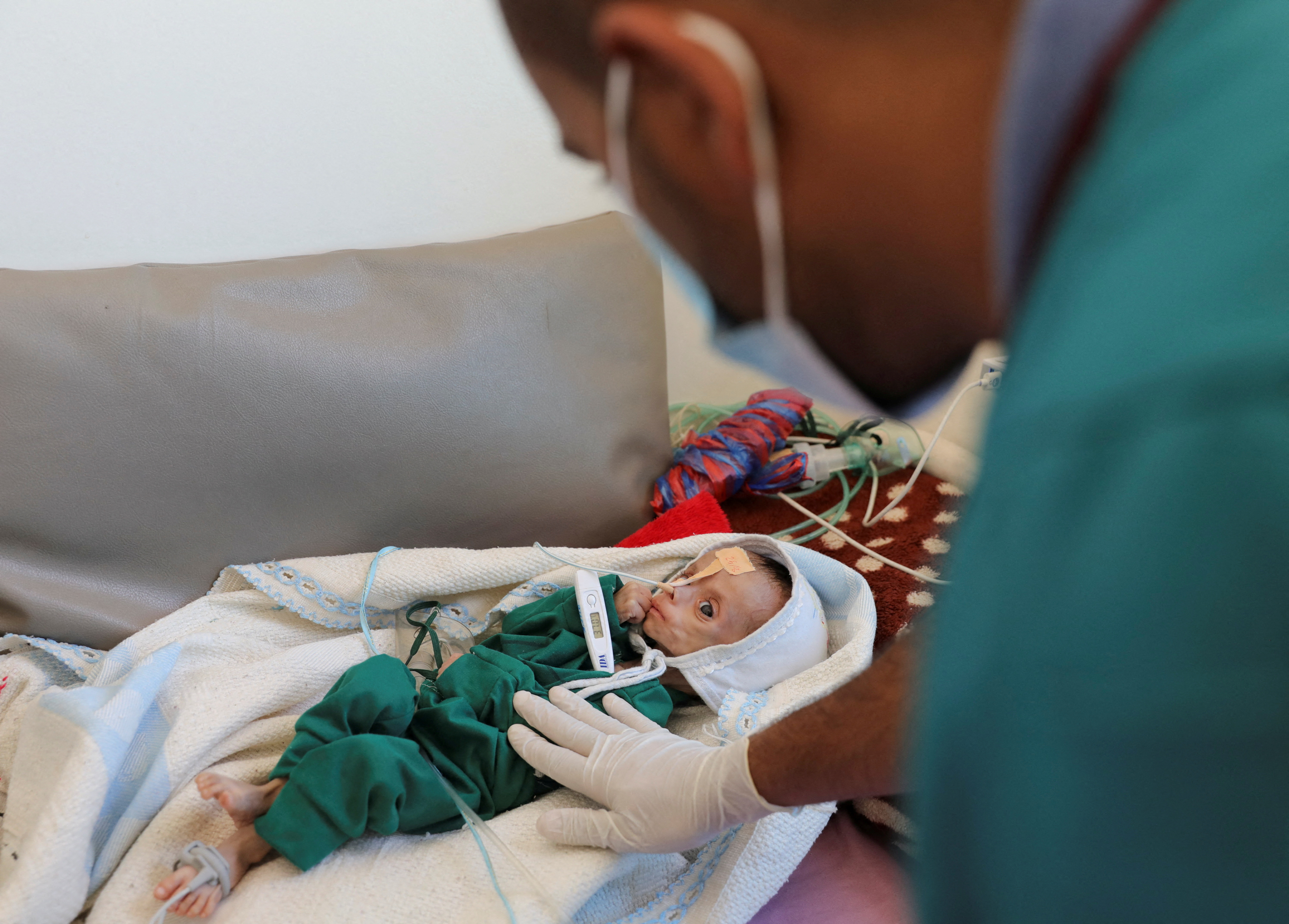 A nutrition specialist attends a six-month-old boy, Wisam al-Salafi, whose parents struggle to provide him with medication or enough food to help him cope with acute malnutrition, at a malnutrition treatment center in Sanaa, Yemen August 26, 2024. REUTERS/Khaled Abdullah TPX IMAGES OF THE DAY