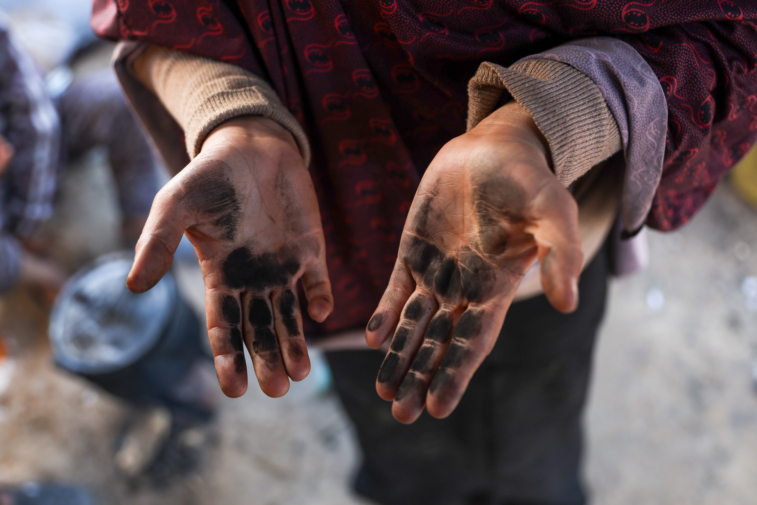 Soot and black smoke stains left by wood fires cover the hands and skin of Islam and many other women forced to cook over open fires since the war on Gaza began 